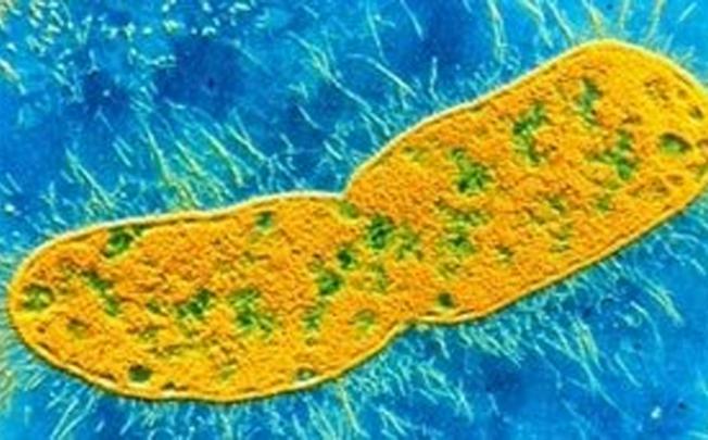 The New Delhi-Metallo-1 superbug. Photo: SMP
