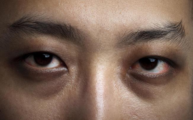 Breathing factor forces rethink on treating insomnia.