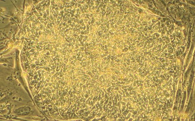 A colony of human embryonic stem cells, which can now be printed.