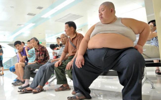 An obese man in China. Weight loss surgery may not be cost-effective for all obese people, a new study says. Photo: Xinhua.