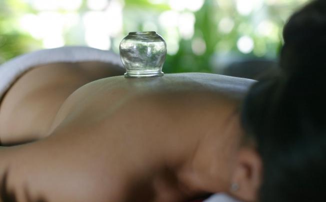 Cupping is used to improve blood flow