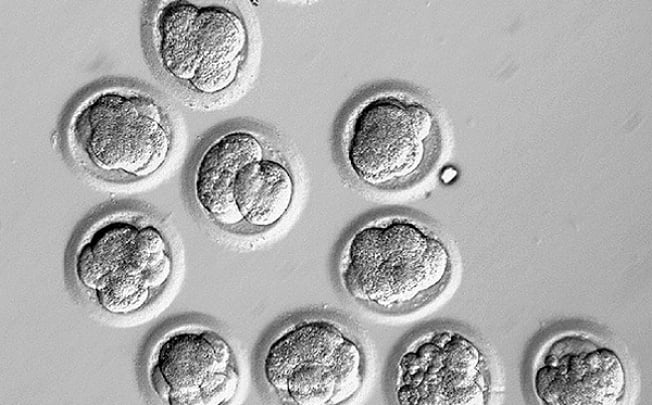 Developing human embryos, nucleated by somatic cell nuclear transfer, during their third day of development. Photo: Reuters