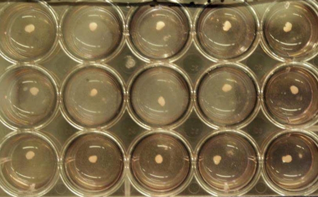 Human liver cells were grown in petri dishes. Photo: NYT