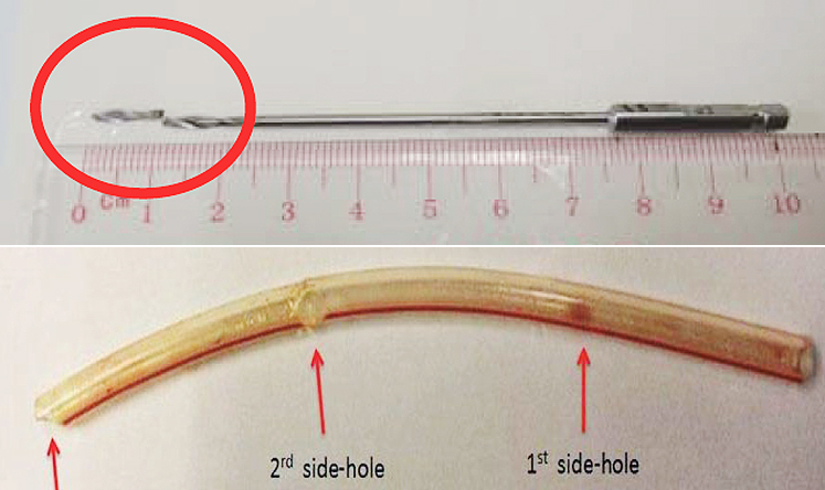 Two of the items left in patients' bodies following surgery: a 1cm drill bit which snapped off during hip surgery, and a 12cm silicon tube. Photos: HA Risk Alert