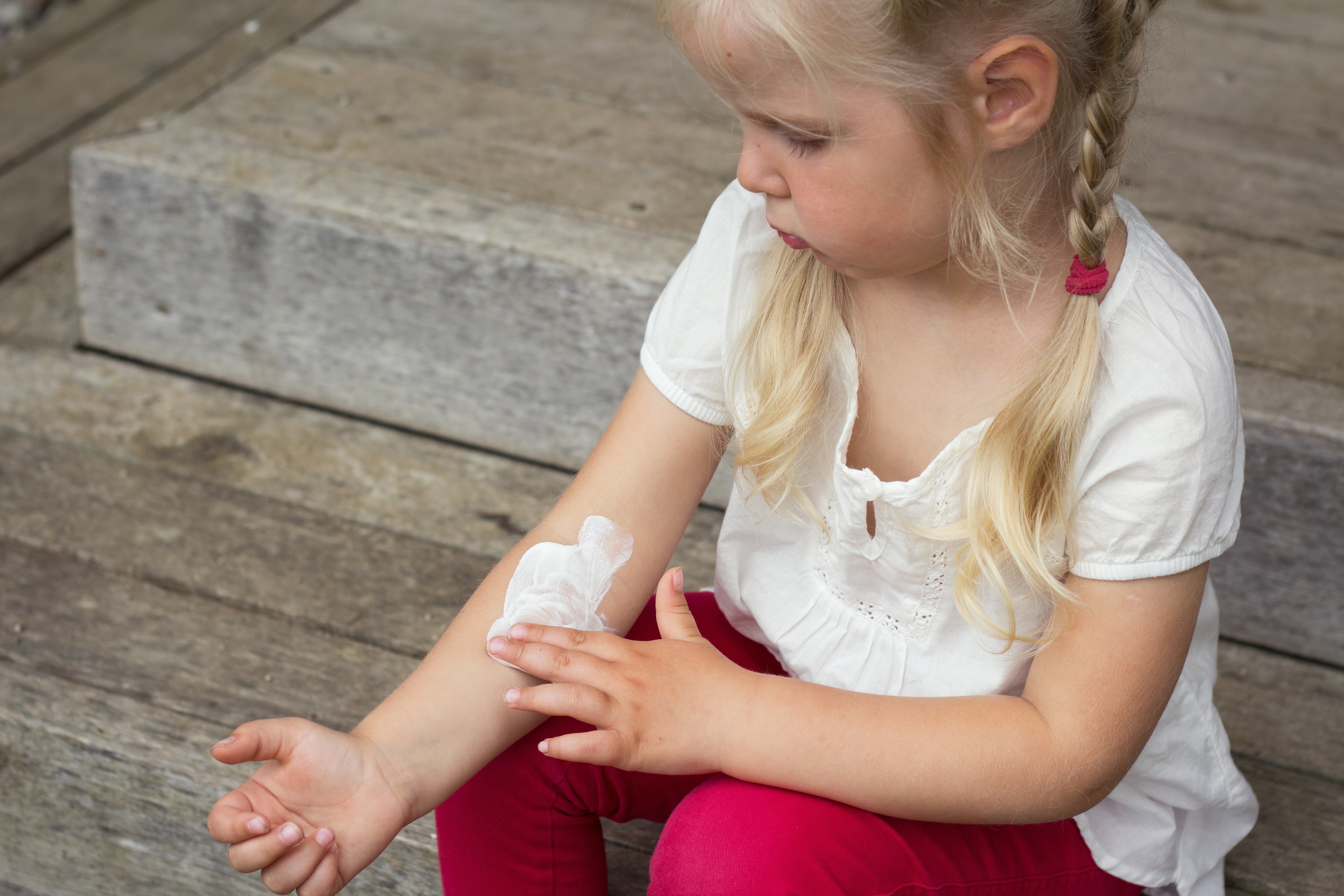 One in five children in developed countries suffer from eczema.