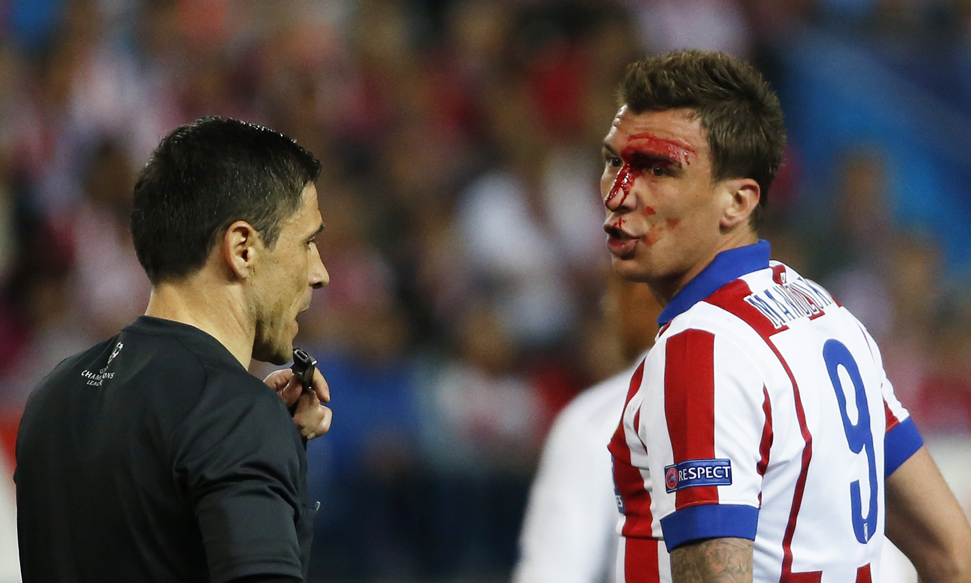 Atletico Madrid's Mario Mandzukic remonstrates with referee Milorad Mazic as he walks off the pitch to receive treatment after sustaining a head injury. Photo: Reuters