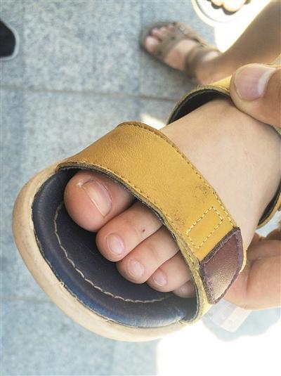 An alleged needle mark in the foot of one of the Bejiing kindergarten pupils. Photo: The Beijing News