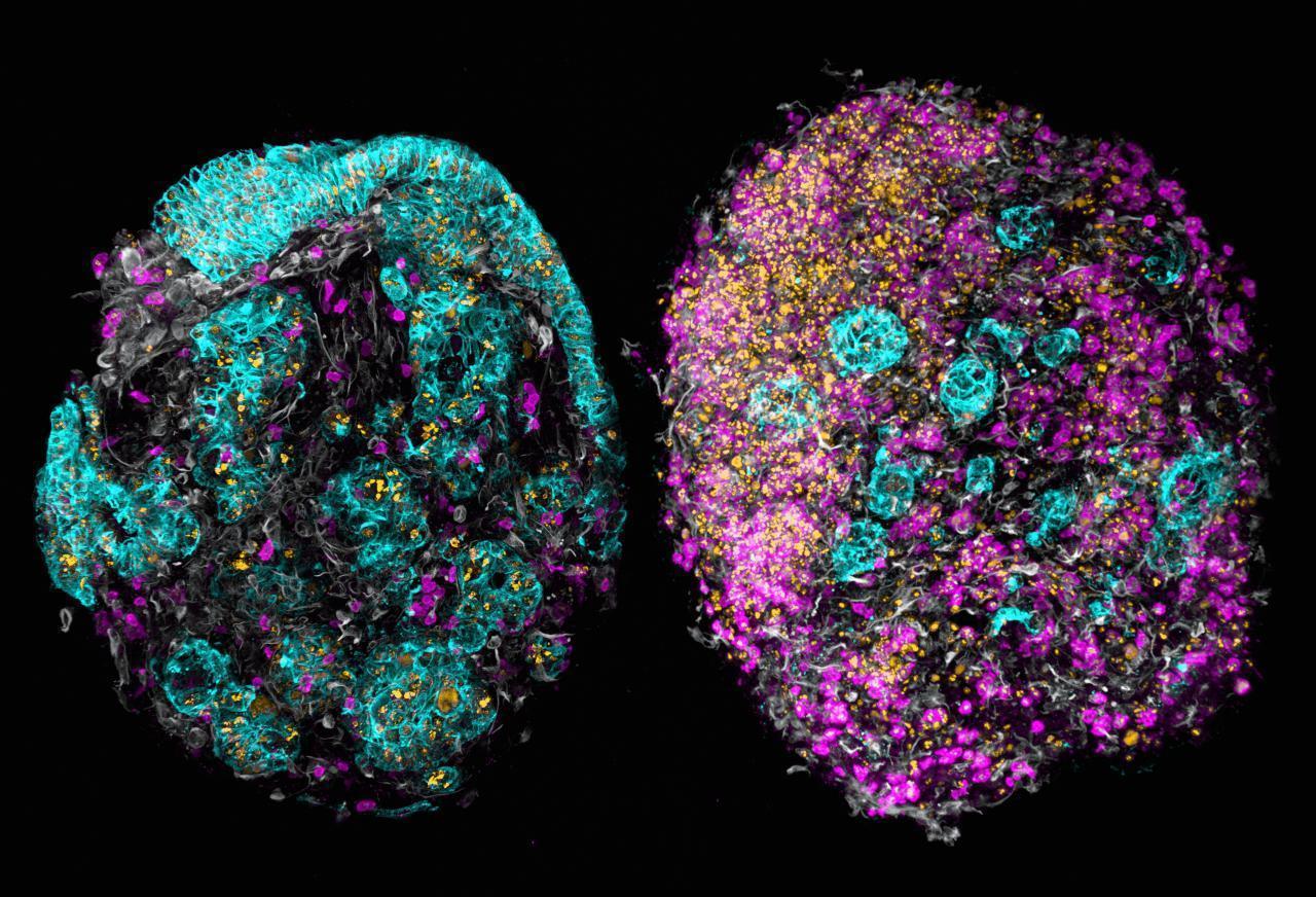 3D Insights into Novel Cancer Models. The imagery is scientifically oriented and may depict medical or biological subjects in explicit detail.