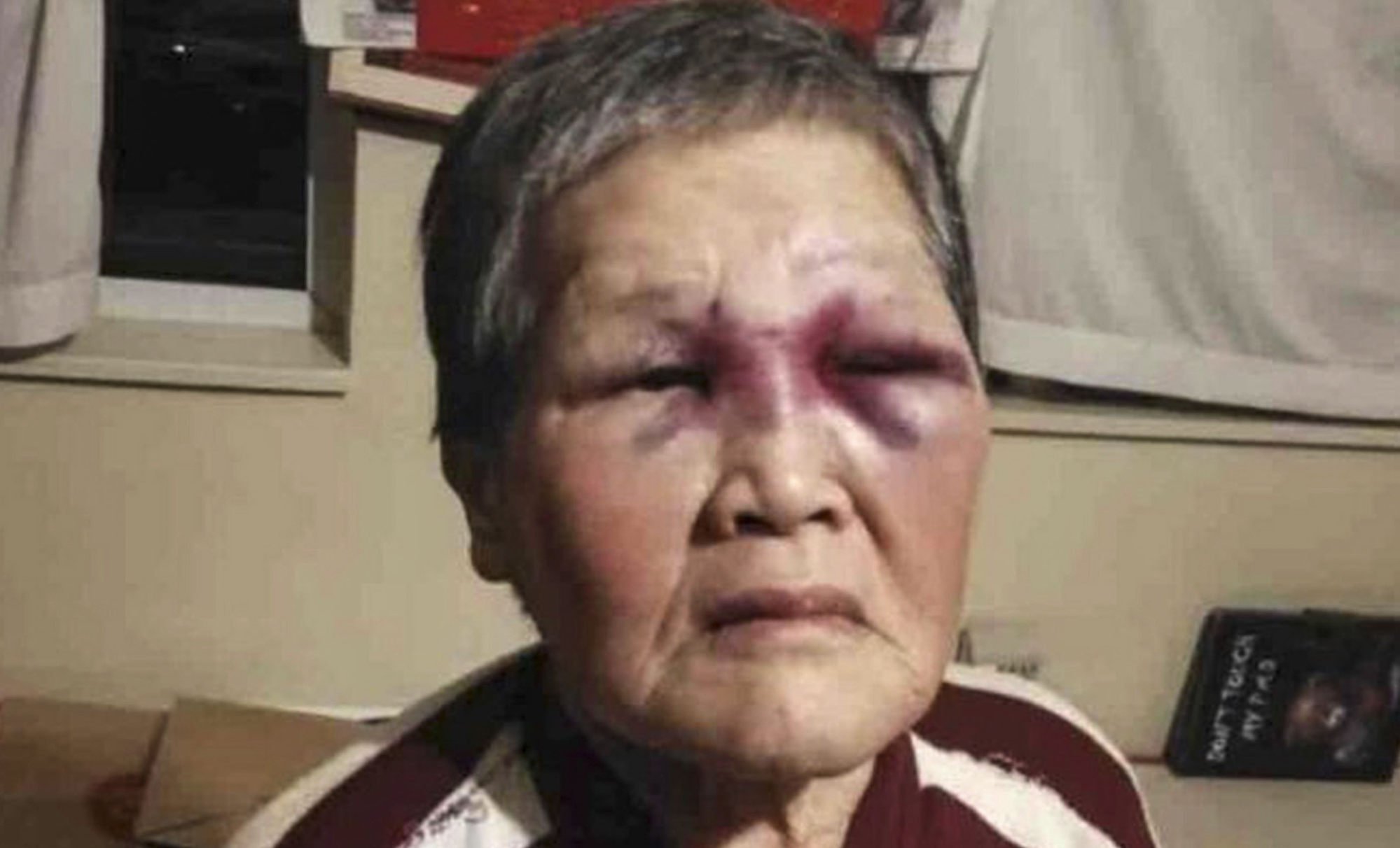 Chinese grandmother Xie Xiaozhen was about to cross the street when her attacker struck. Photo: GoFundMe