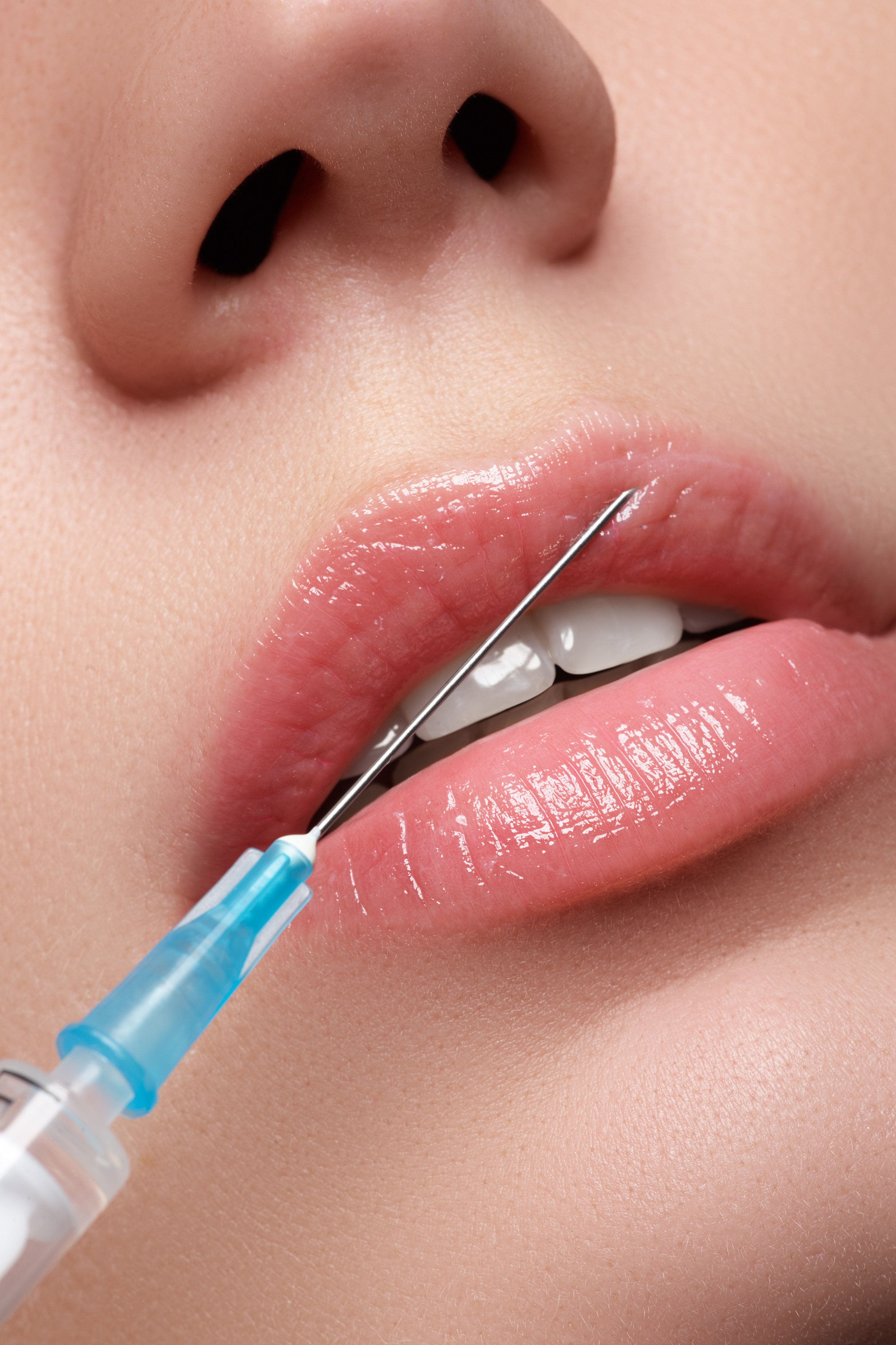 An unlicensed medical practitioner has been arrested in Hainan after a woman died during a cosmetic procedure. Photo: Shutterstock