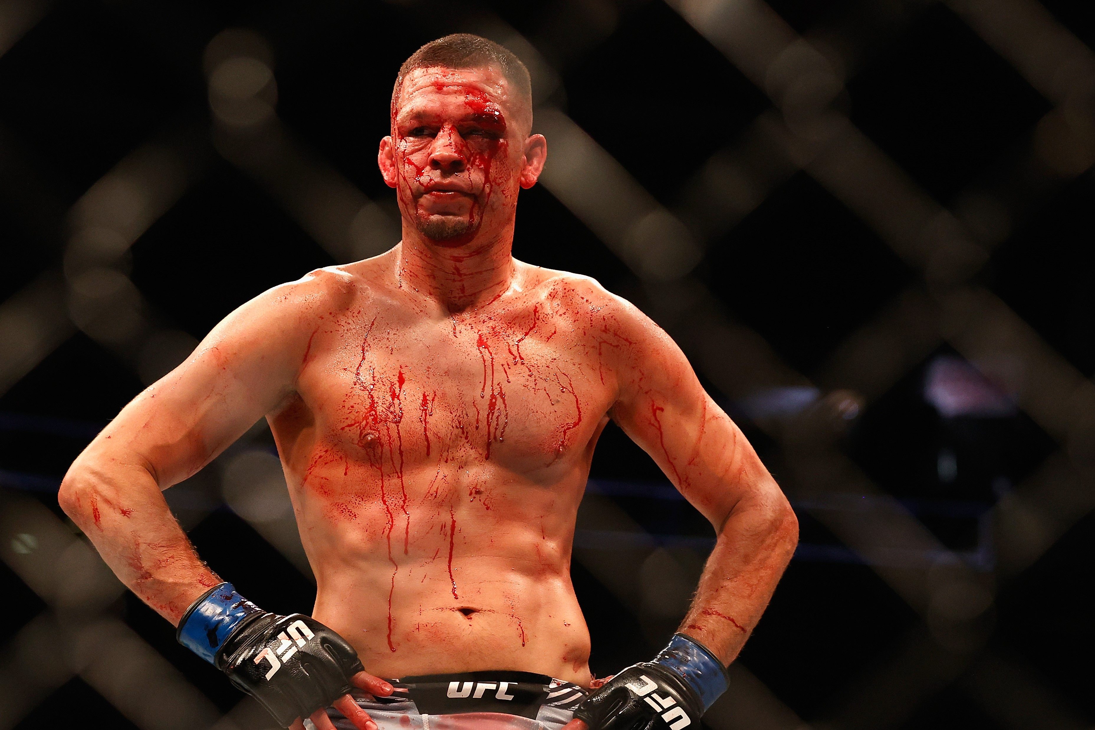 UFC welterweight fighter Nate Diaz after his fight against division contender Leon Edwards at UFC 263 in the Gila River Arena, Arizone in June. Photo: AFP   