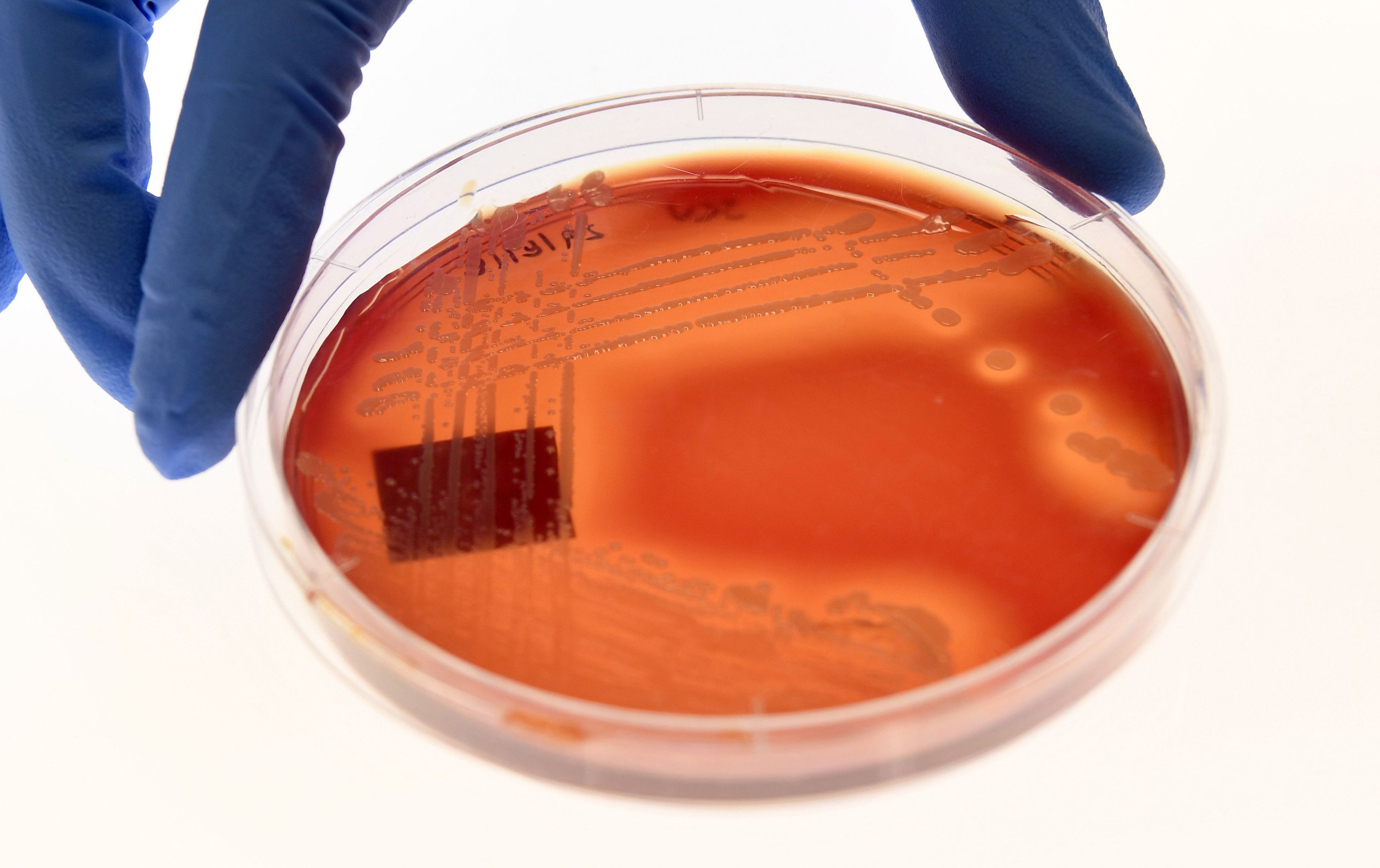 Staphylococcus epidermidis, a bacterium found on human skin, and one of the most common causes of hospital-associated infections, is displayed on an agar plate in Melbourne. As antibiotics are used over and over again, more bacteria are evolving into drug-resistant superbugs. Photo: TNS