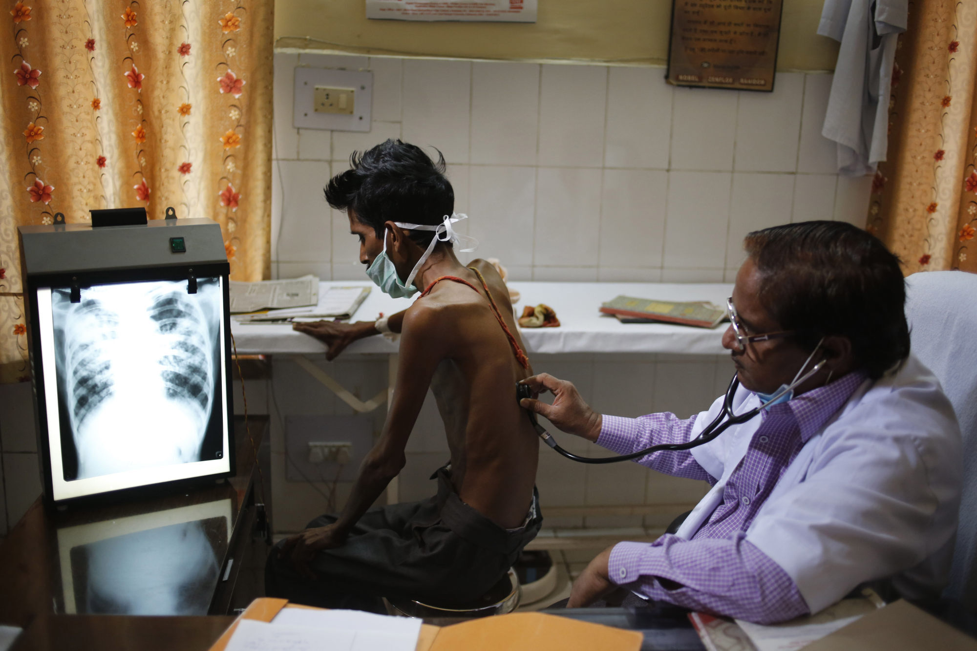 A doctor examines a tuberculosis patient in a government TB hospital in Allahabad, India. Photo: AP