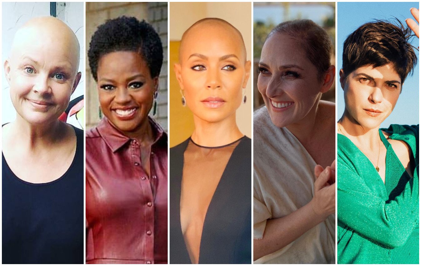 10 celebrities speaking candidly about hair loss