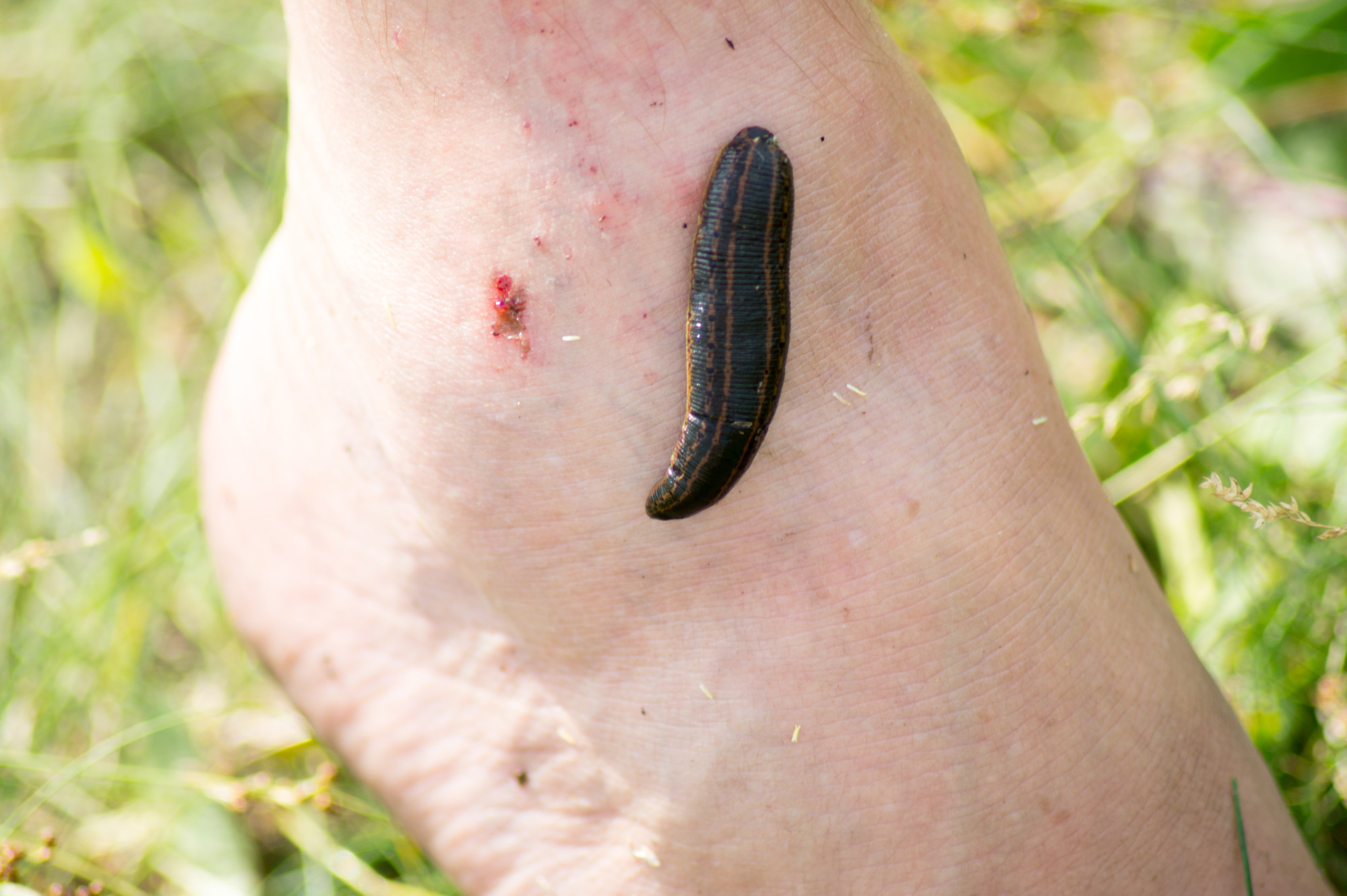 Mother nature may be providing a tool to monitor biodiversity: bloodsucking  leeches