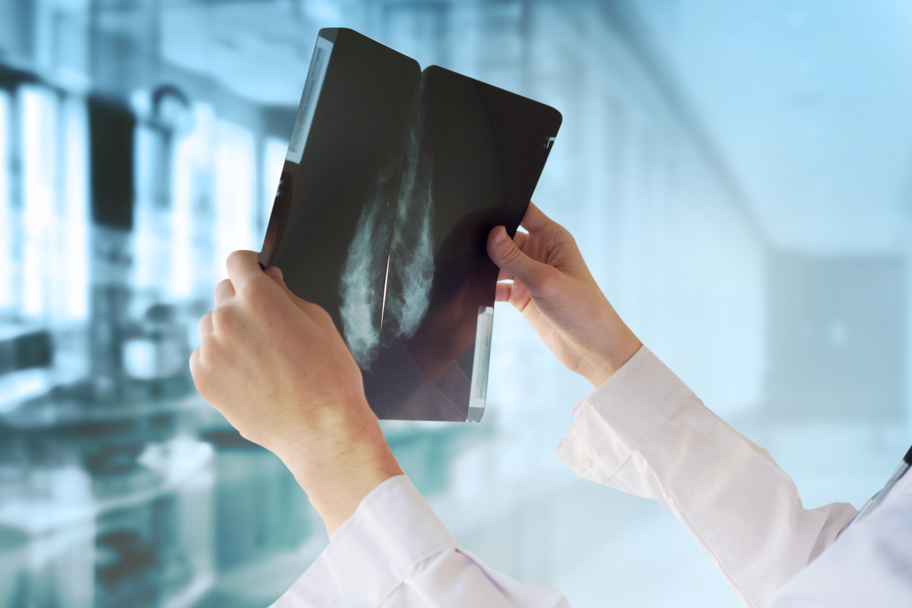 A doctor examines a mammogram to check for signs of breast cancer. Every woman in Hong Kong in an at-risk age group should get screened. Photo: Shutterstock