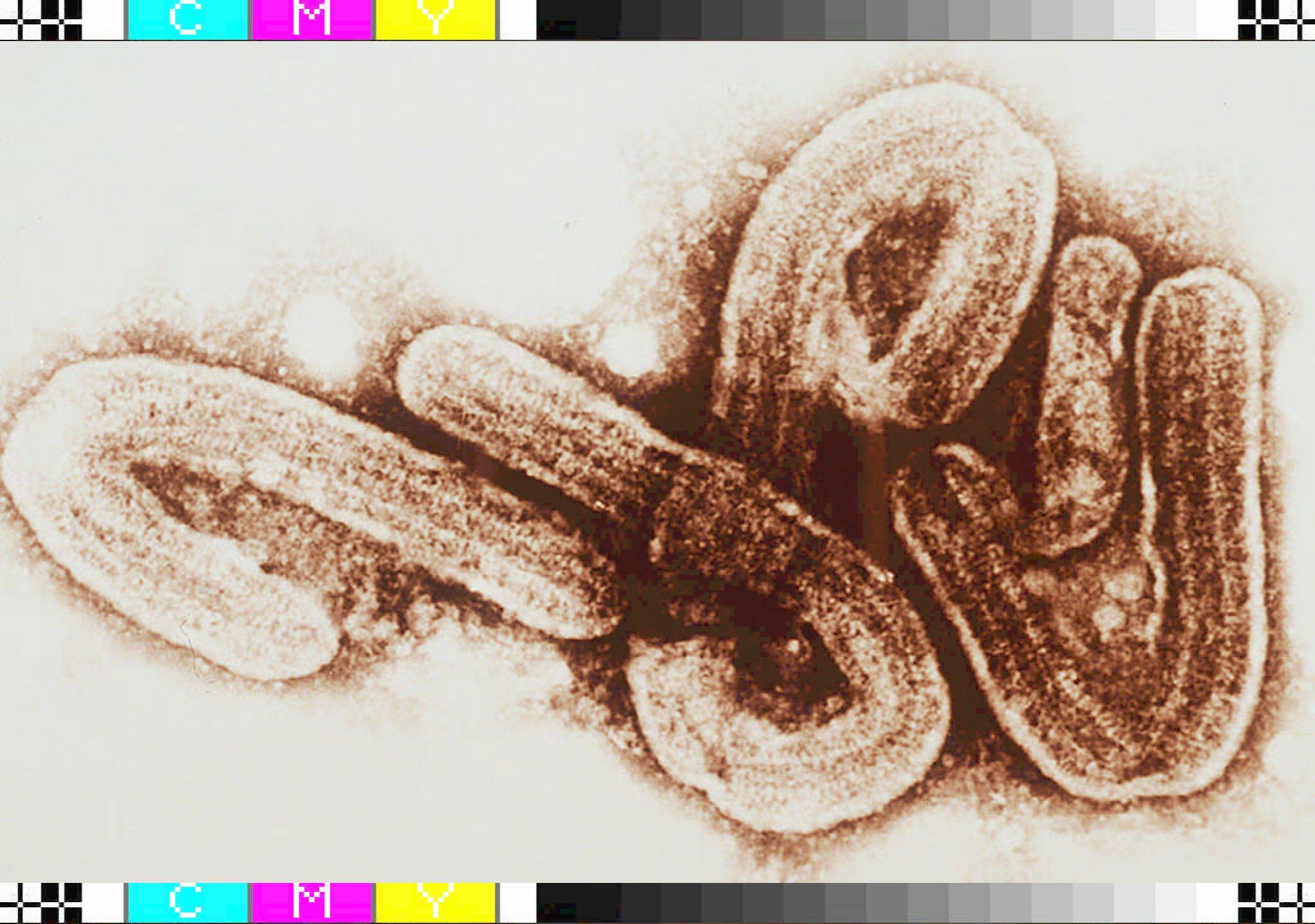 An undated microscopic view of the Marburg-Ebola virus. File Photo: AFP
