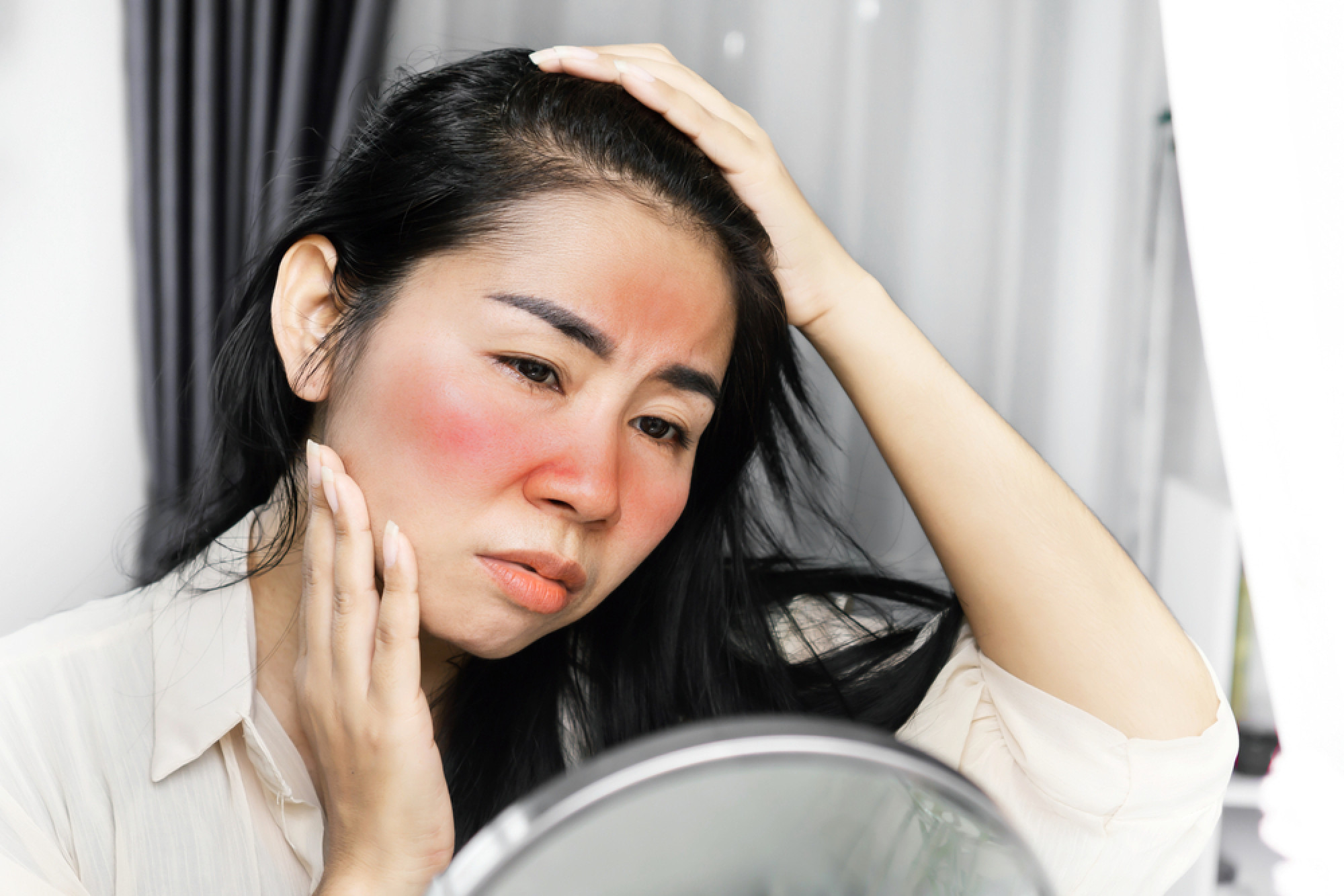 We sometimes don’t see sun damage until years after exposure. Photo: Shutterstock