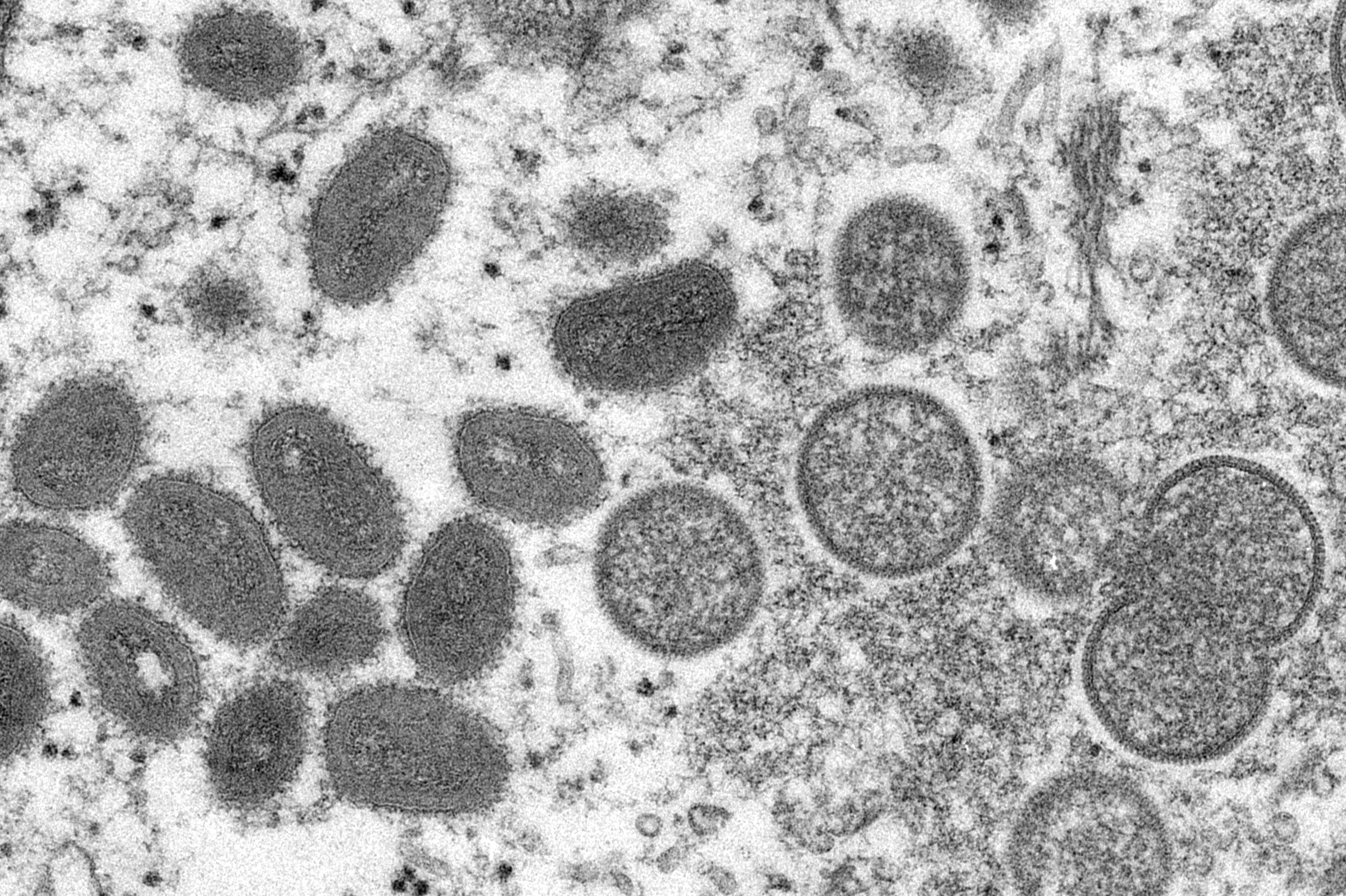 China’s General Administration of Customs has announced new prevention measures in an attempt to stop monkeypox being introduced into China. Photo: CDC via AP