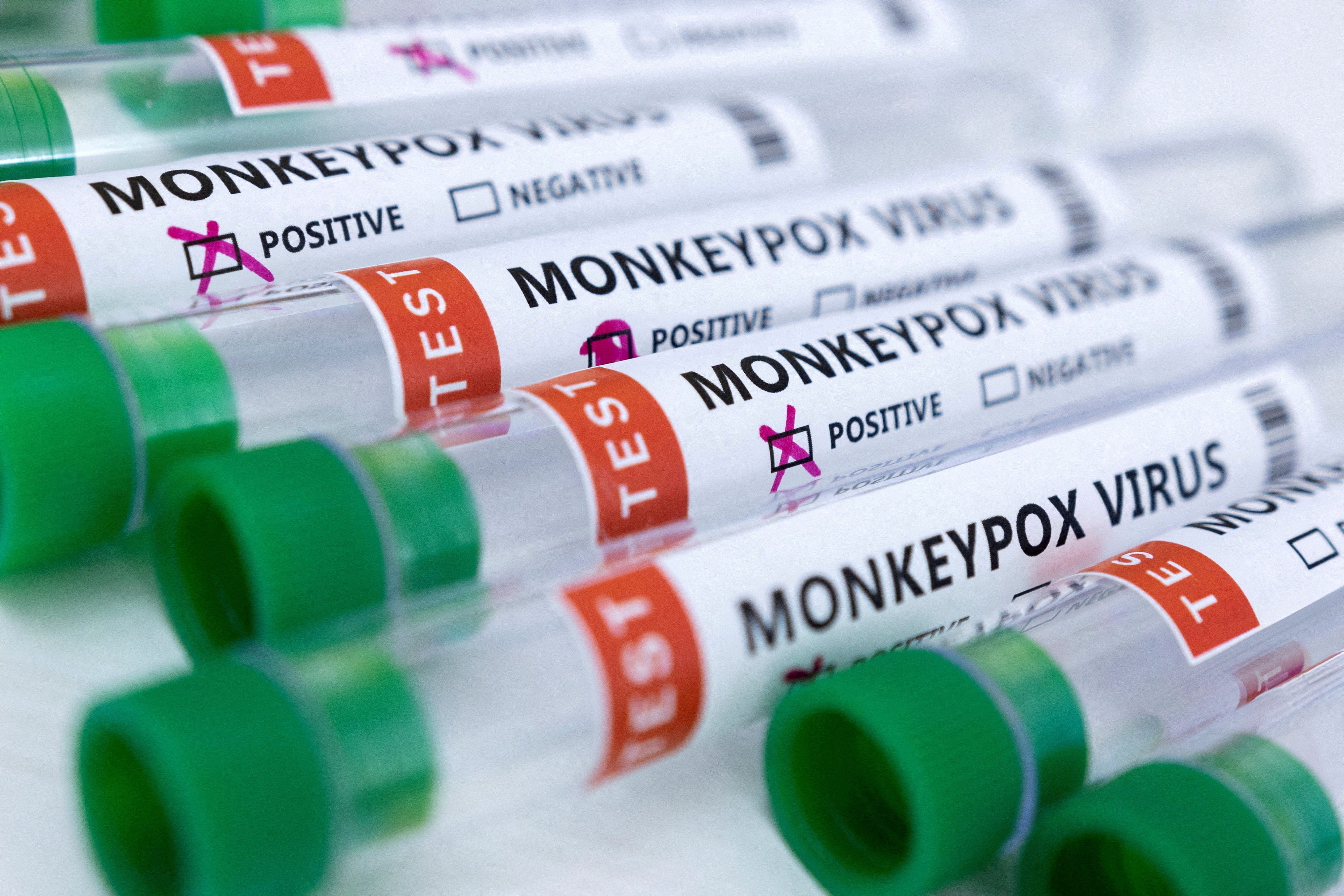 The Philippines has detected its first case of monkeypox in a person with a history of overseas travel, officials said on Friday. Photo: Reuters
