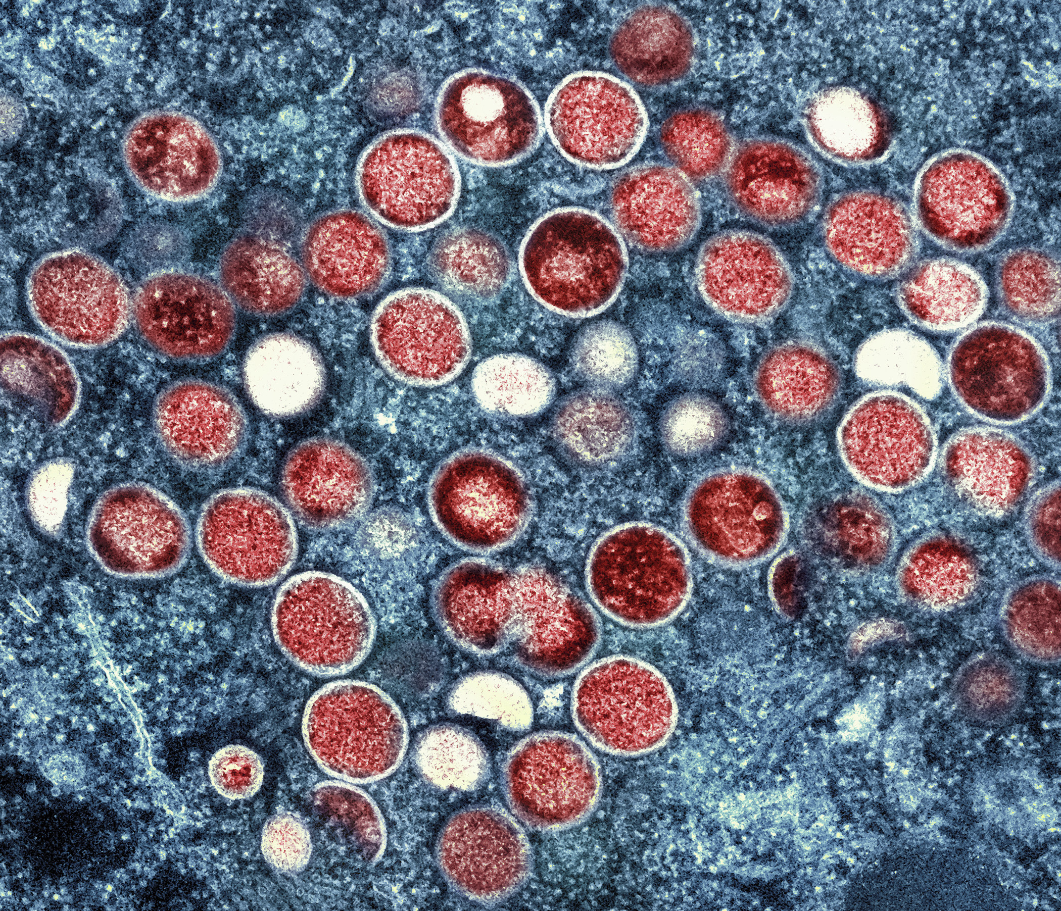 A colourized transmission electron micrograph of monkeypox particles (red) found within an infected cell (blue), cultured in the laboratory. Image: NIAID via AP