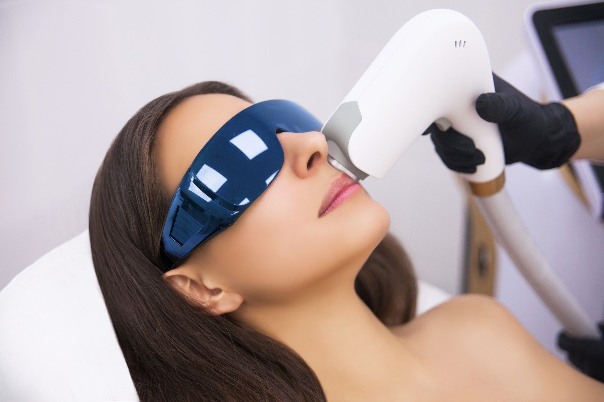 Intense pulse laser (above) is effective for dark spots, while Accent Prime works on skin tightening and body contouring. Photo: Shutterstock