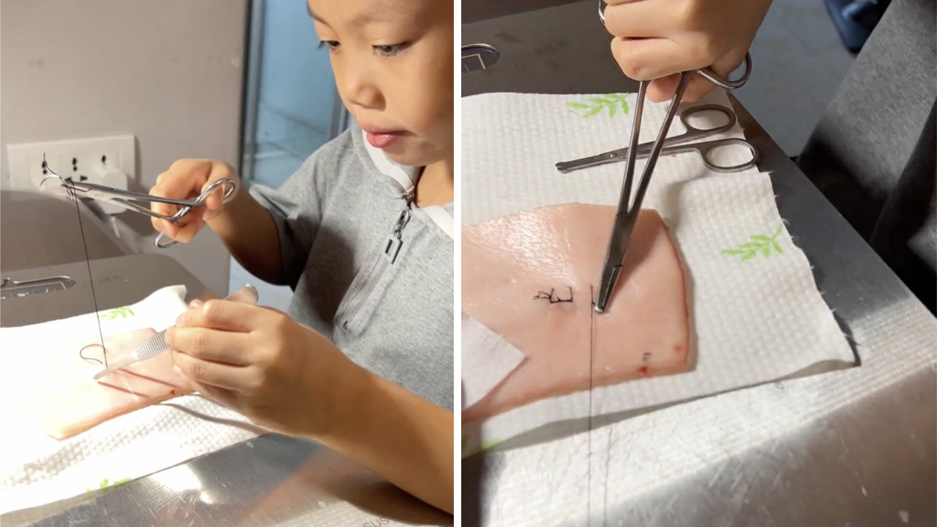 A girl in China, aged 8, stuns social media in a video showing her demonstrating suturing techniques taught by her father who is a doctor. Photo: SCMP composite