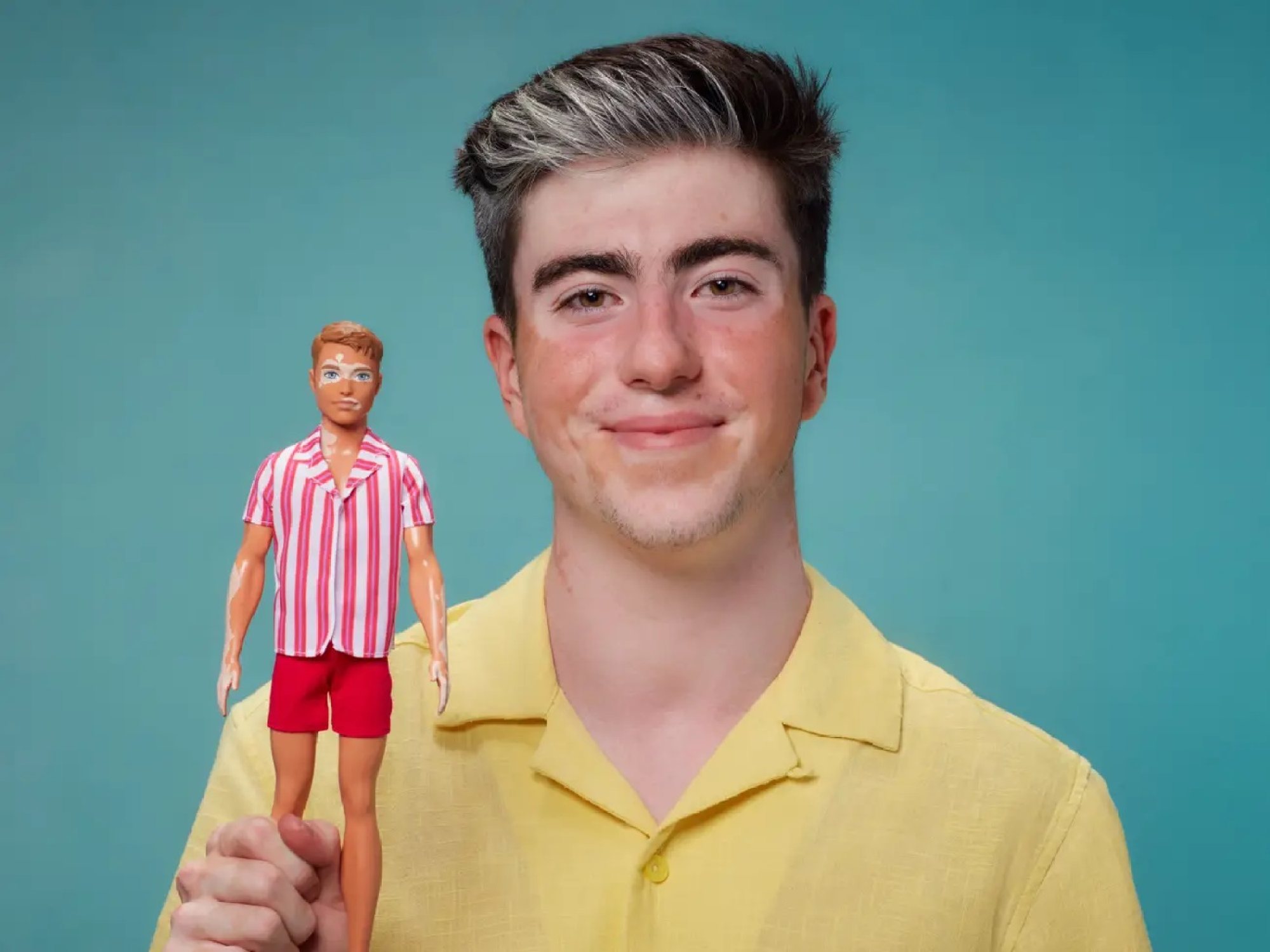 Barbie and Ken reflect body diversity with hearing aids, colourful