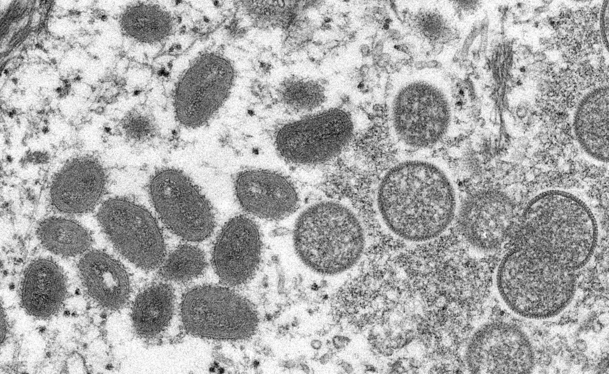 An electron microscopic image depicting a monkeypox virion. Photo: TNS
