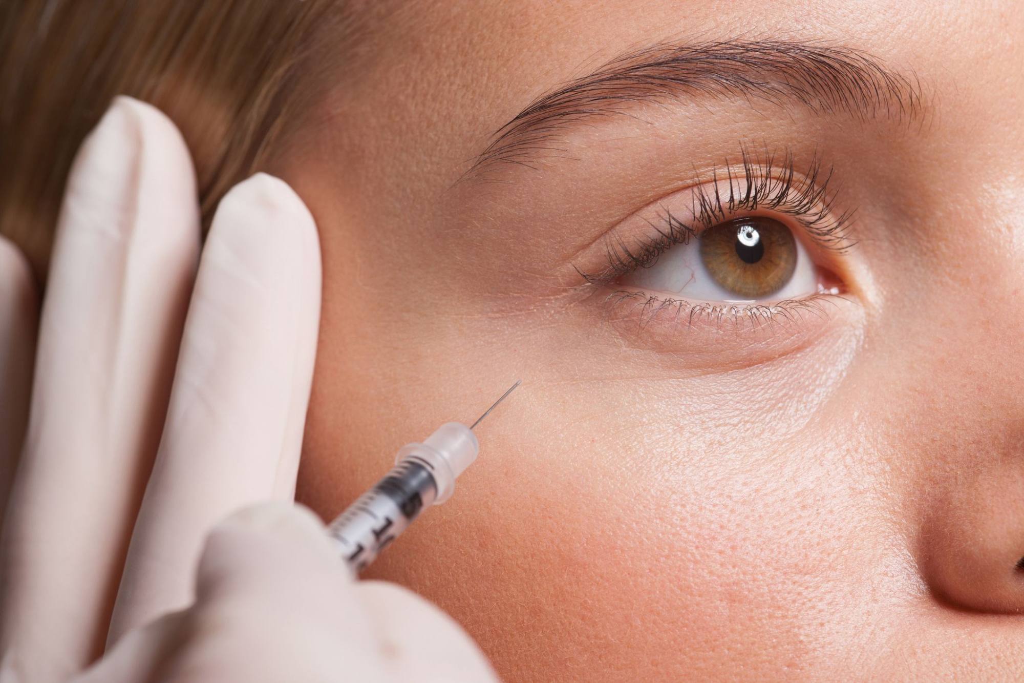 When To Start Botox And Why People In Their 20s Are Getting It ...