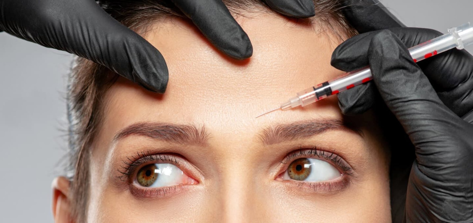 When To Start Botox And Why People In Their 20s Are Getting It ...