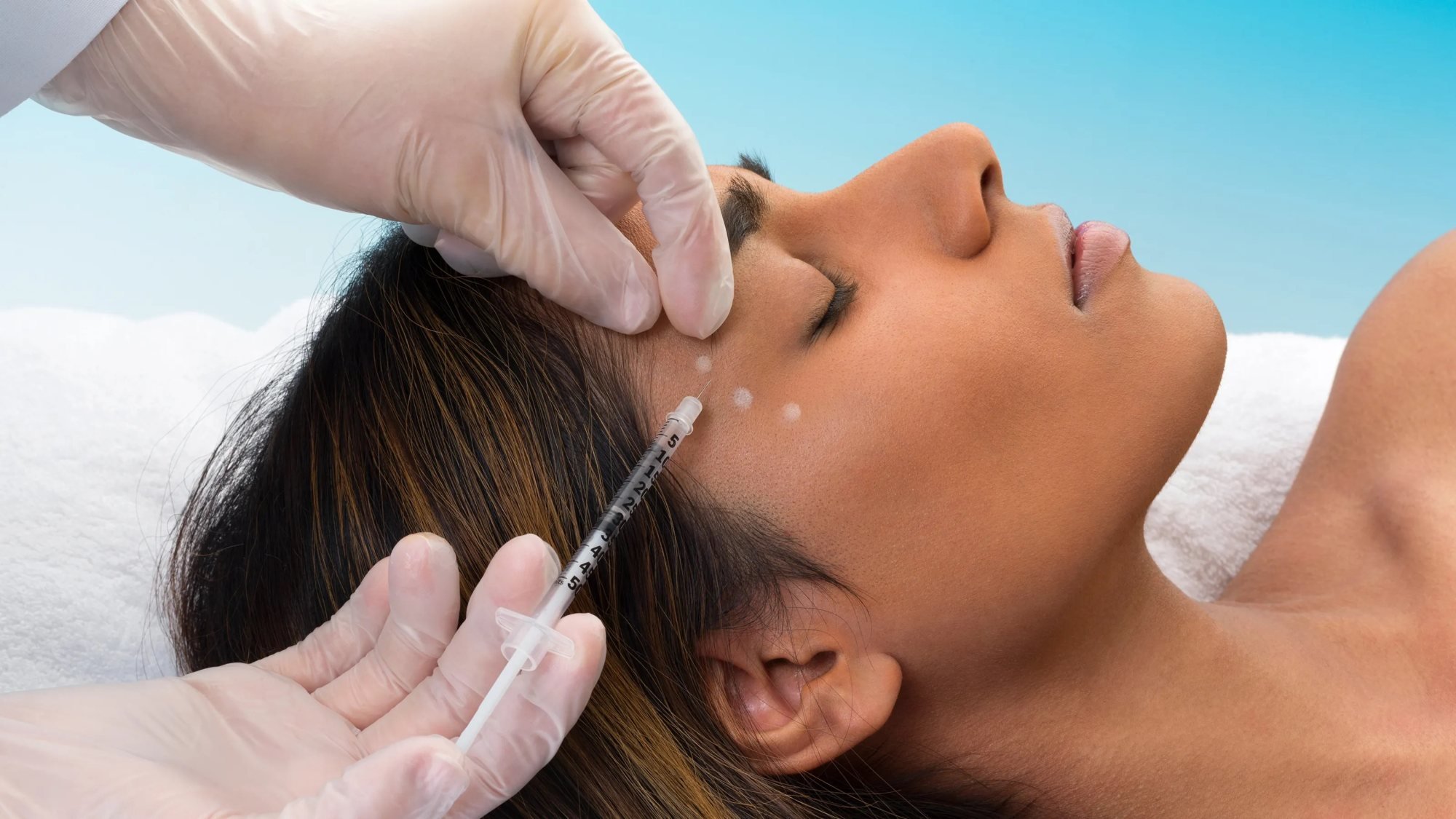 Most neuromodulators offer results that may last up to three months.