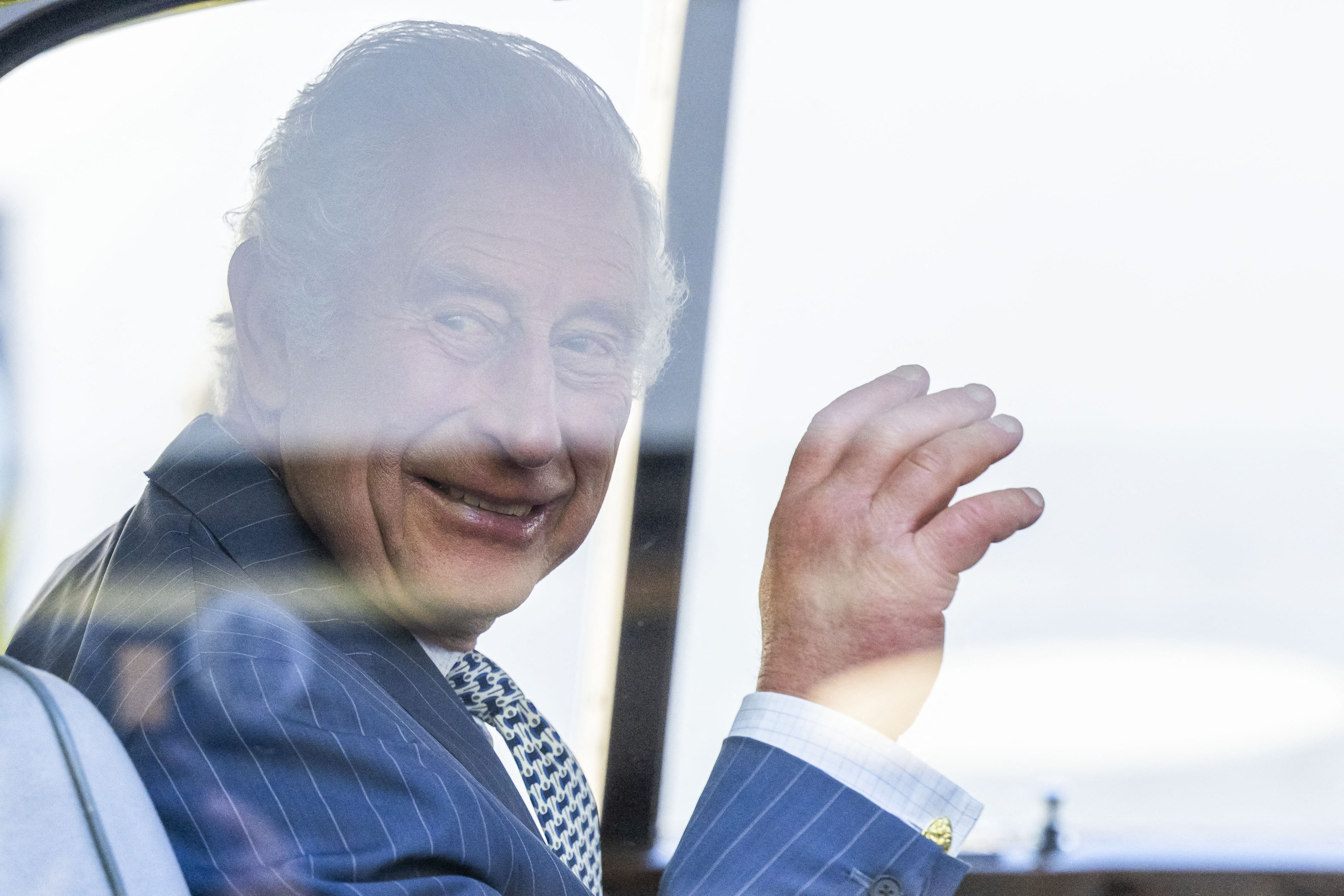 King Charles’ fingers have drawn attention recently for their puffiness and redness. It turns out our hands say a lot about our health. Photo: AFP