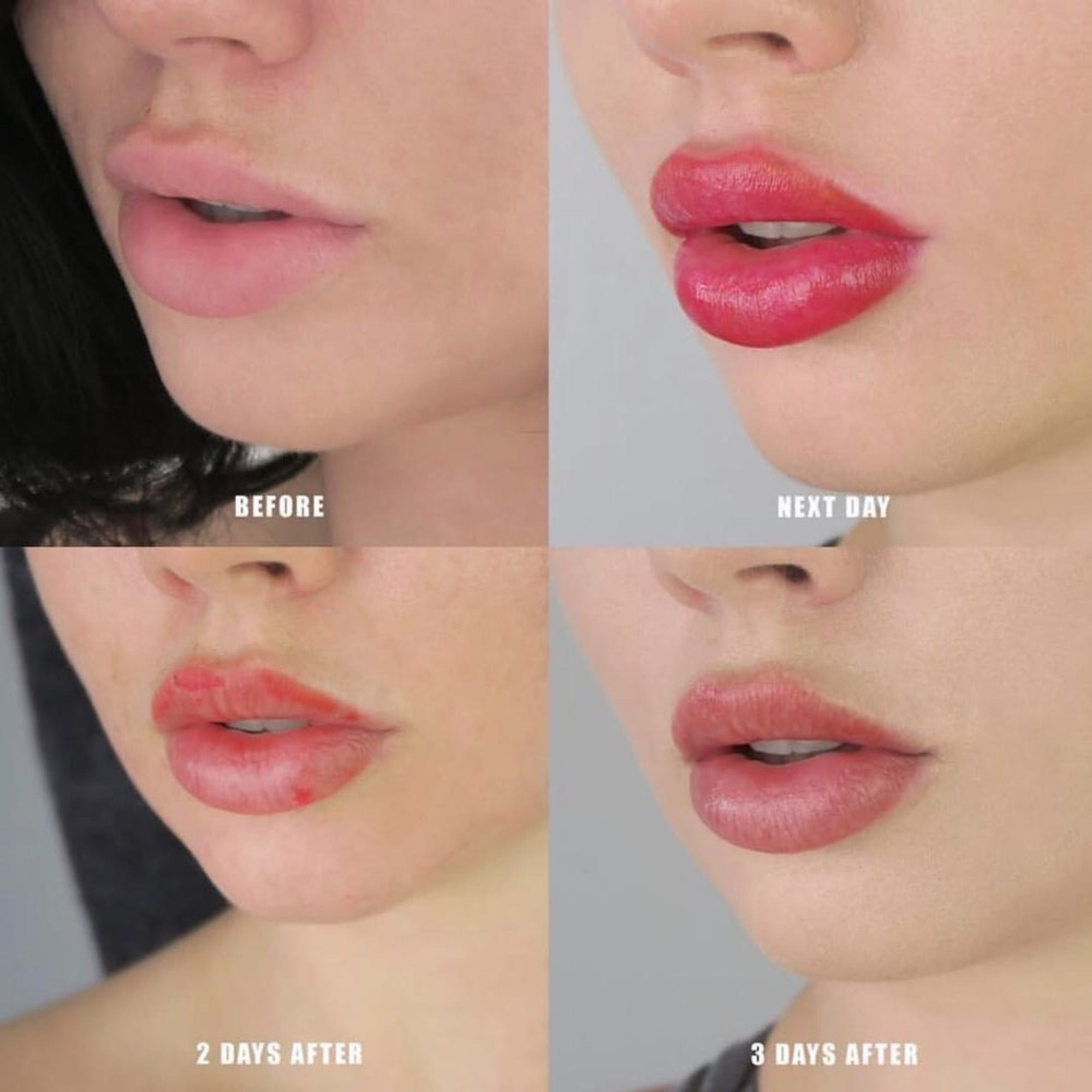 Touch-ups may be needed more frequently when it comes to lip blushing. Photo: Handout