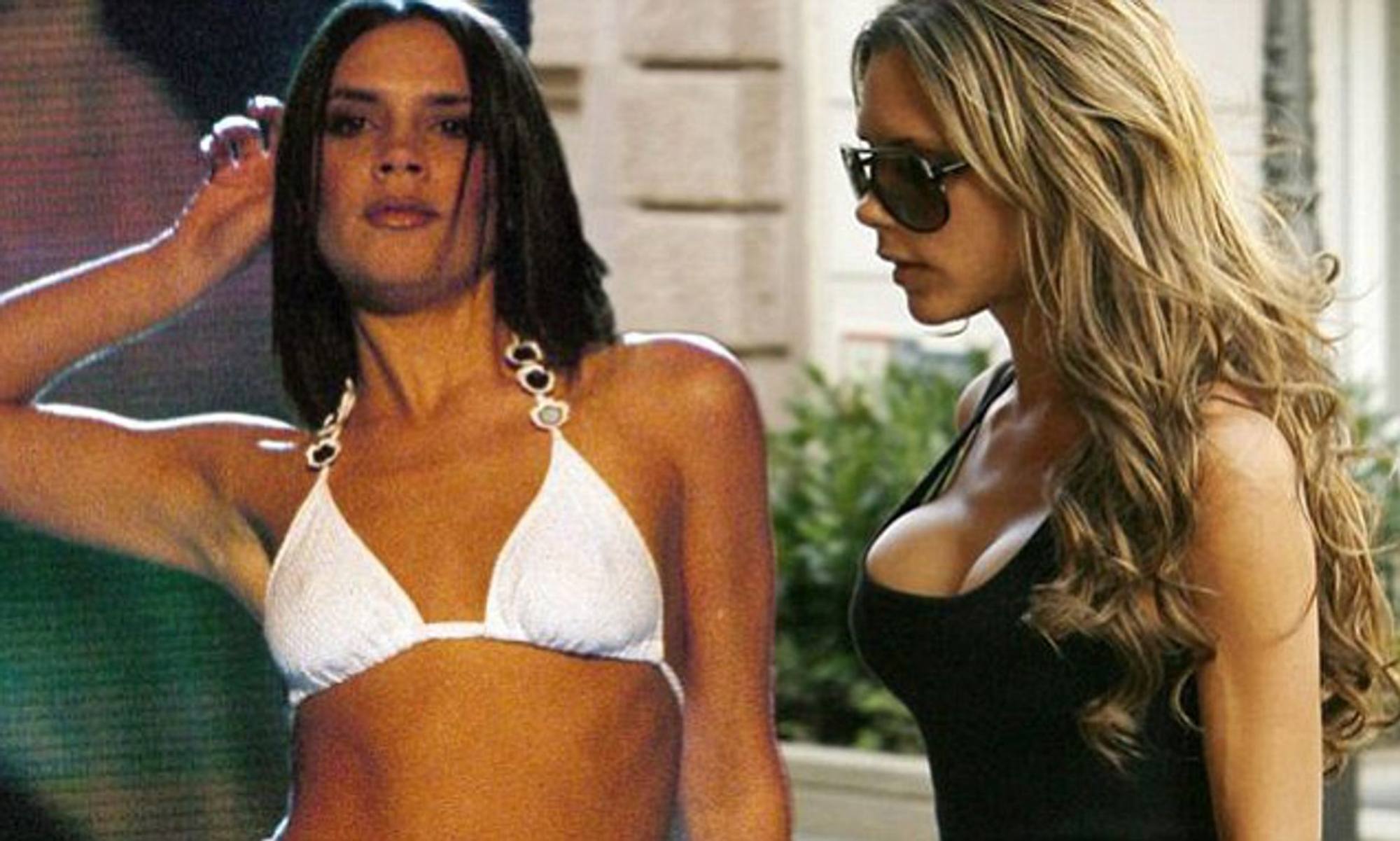 Plastic surgery reversal: why Victoria Beckham and other celebrities have  done it, what can and can't be reversed, and why it's so popular in 2022