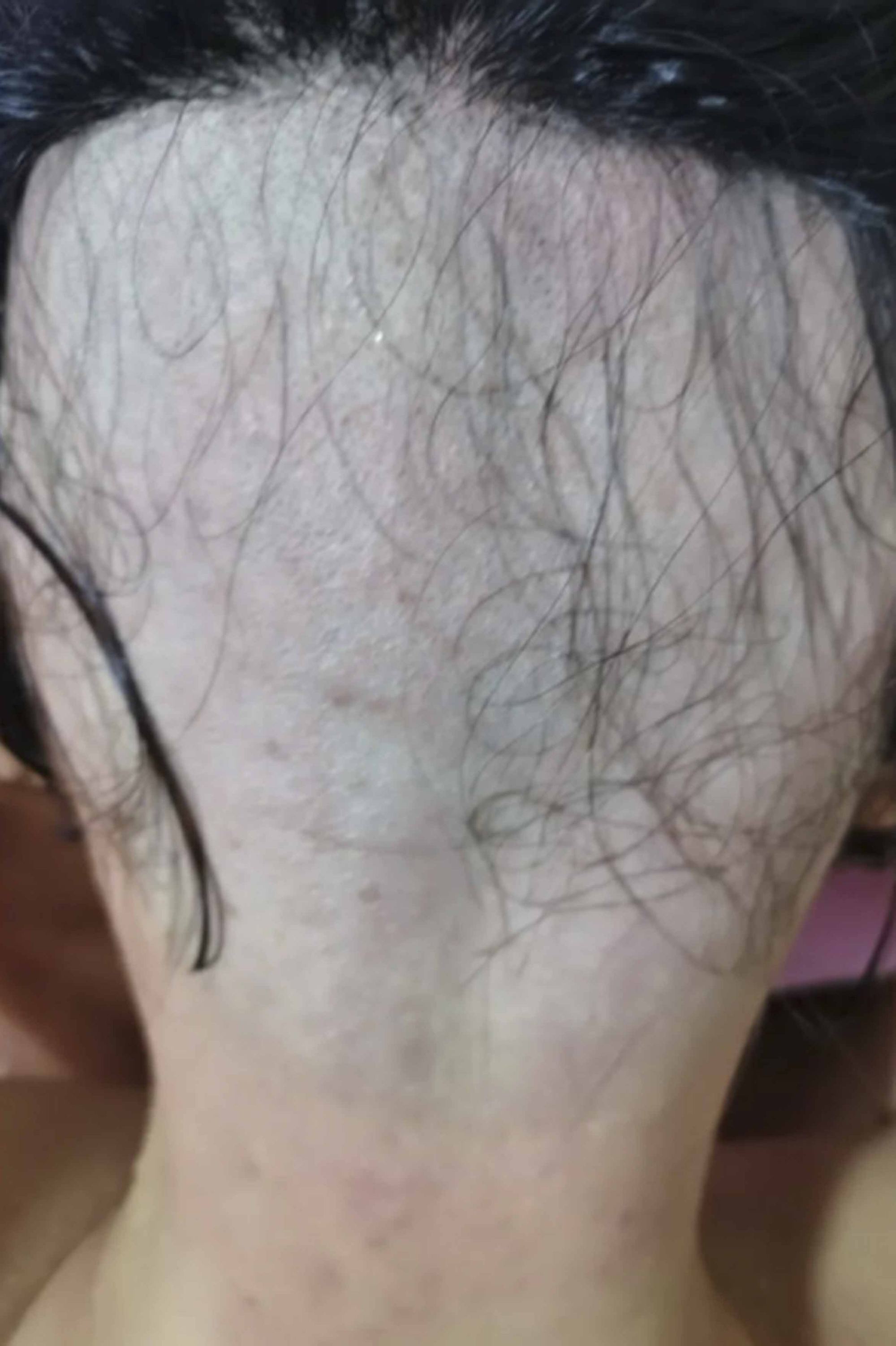 A Chinese woman who was tricked by an offer of cash to have a “short’ haircut ended up half bald before discovering she had been videoed for a sleazy, head- shaving fetish website. Photo: Thepaper