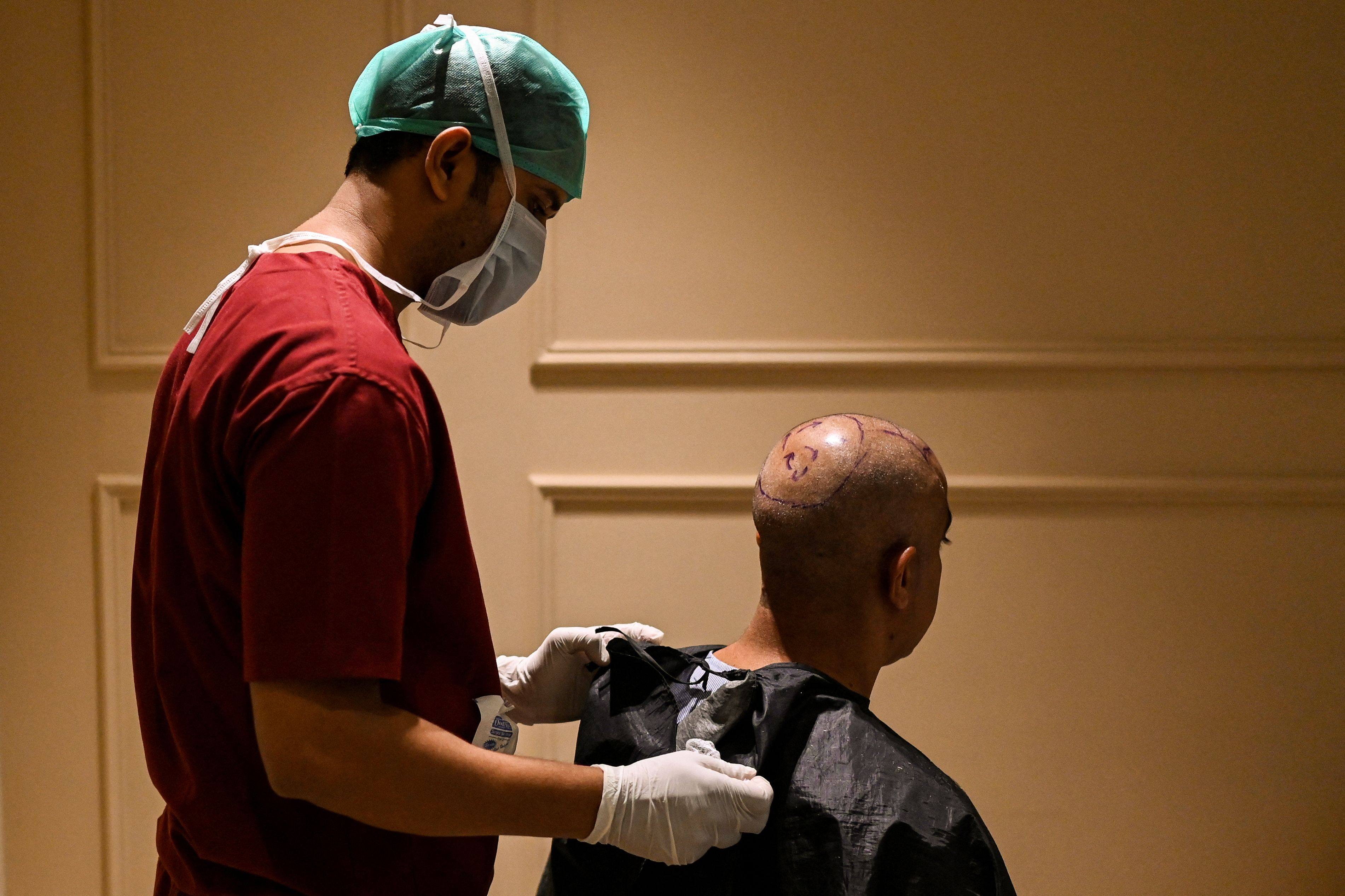 How Indian man's hair transplant turned fatal | South China Morning Post