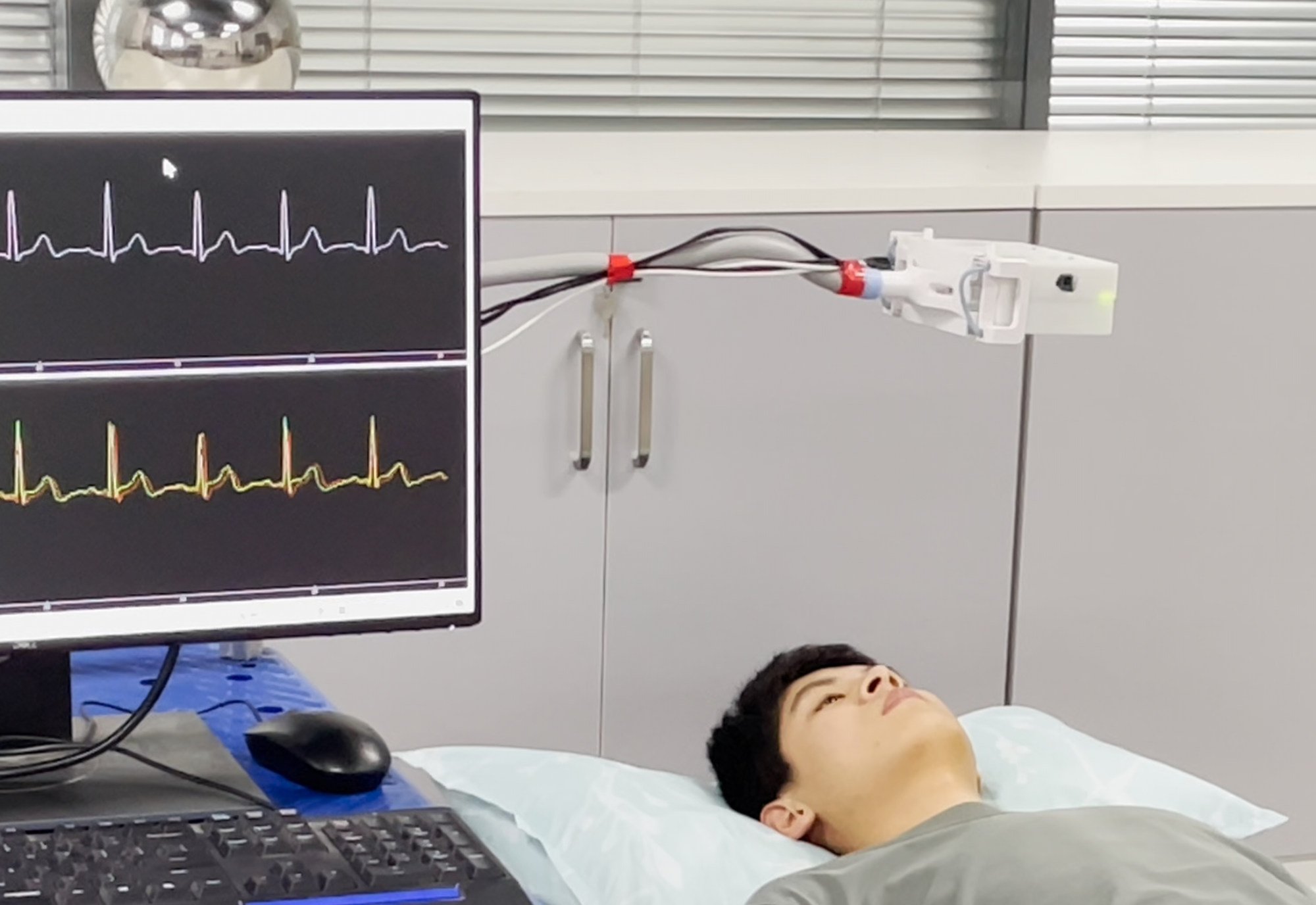 Chinese scientists used a millimetre wave radar to detect the movements of the heart and transform that information into electrical signals. Photo: The University of Science and Technology of China