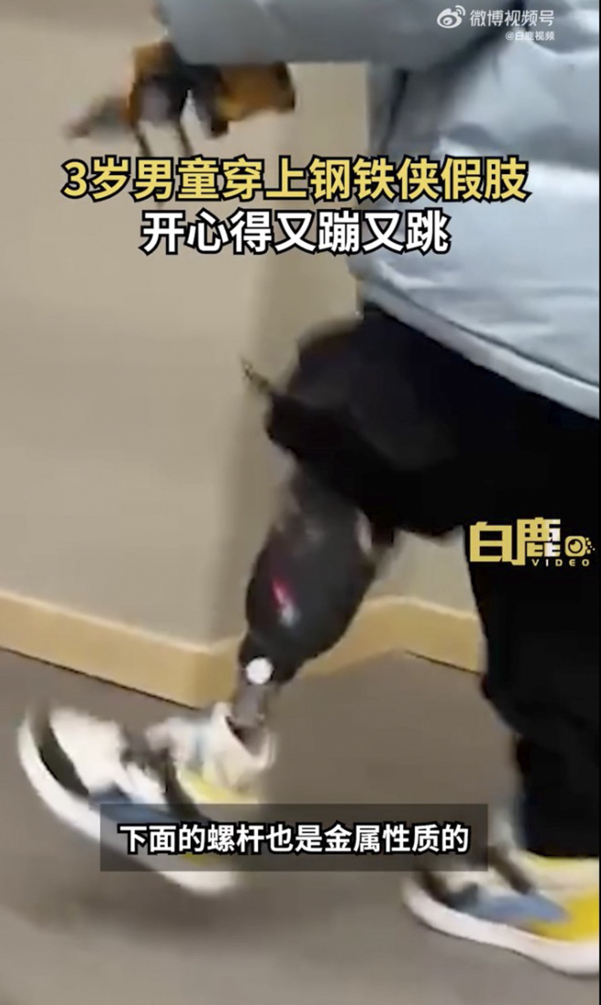 Little Yicheng, who lost his leg in traffic accident, runs towards his parents wearing his new custom-made prosthetic “Iron Man” leg. Photo: Weibo