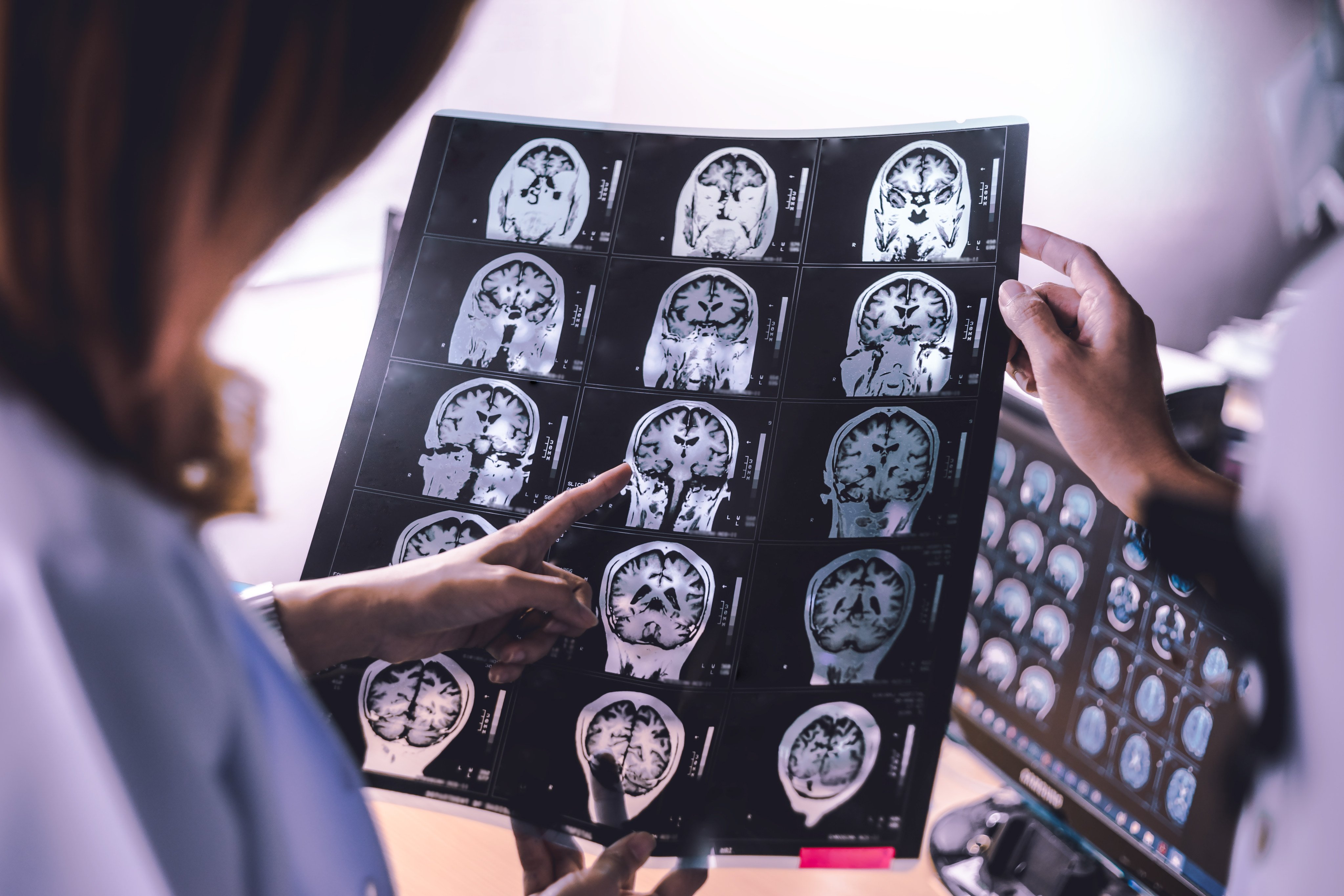 It can be daunting to get a brain scan to test for signs of dementia, but a neurologist behind new research reveals the advantages of knowing early. Photo: Shutterstock