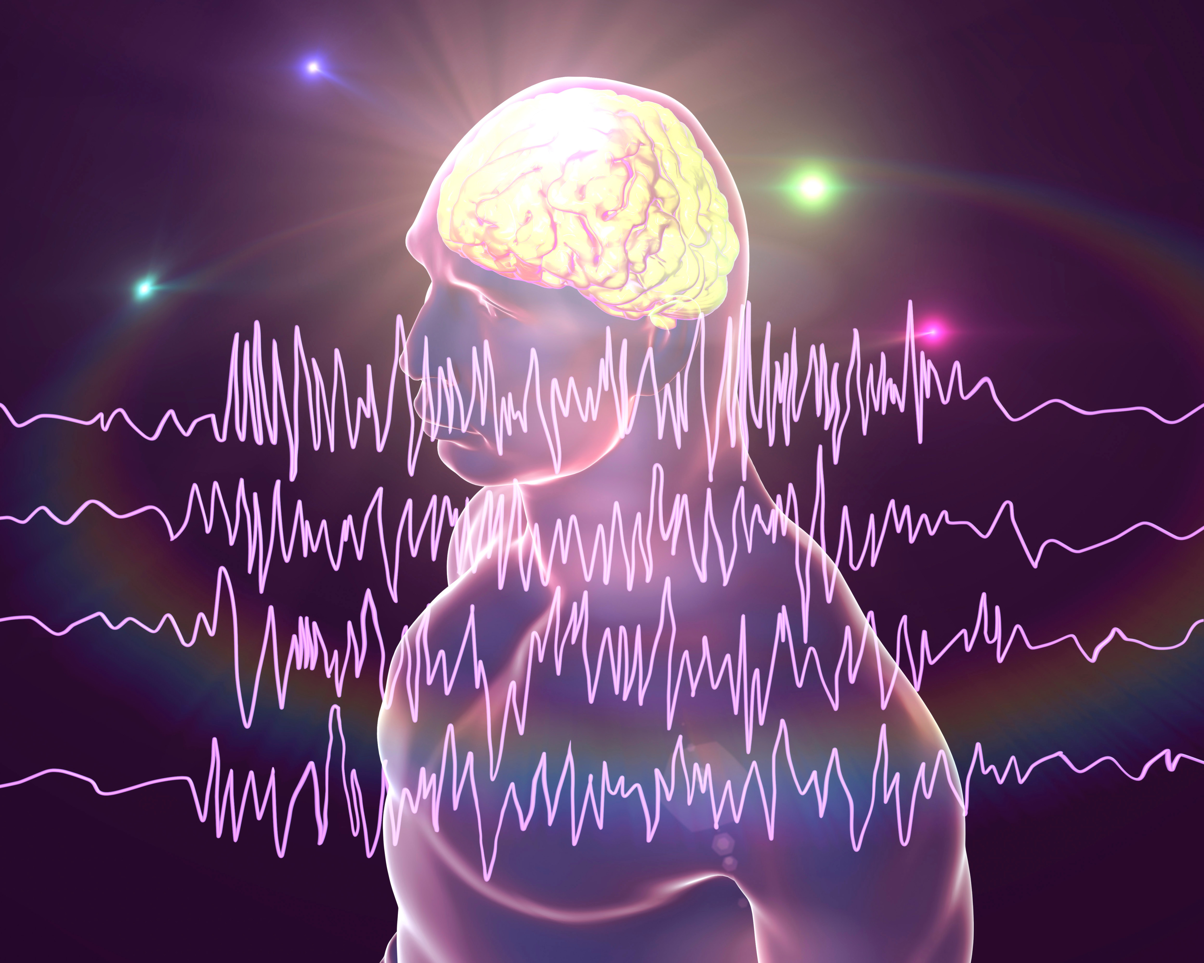 One in 10 people have at least one seizure in their lifetime. A research team in Hong Kong has found a new way to treat one of the most common forms of epilepsy, and shown it works in mice. Photo: Shutterstock