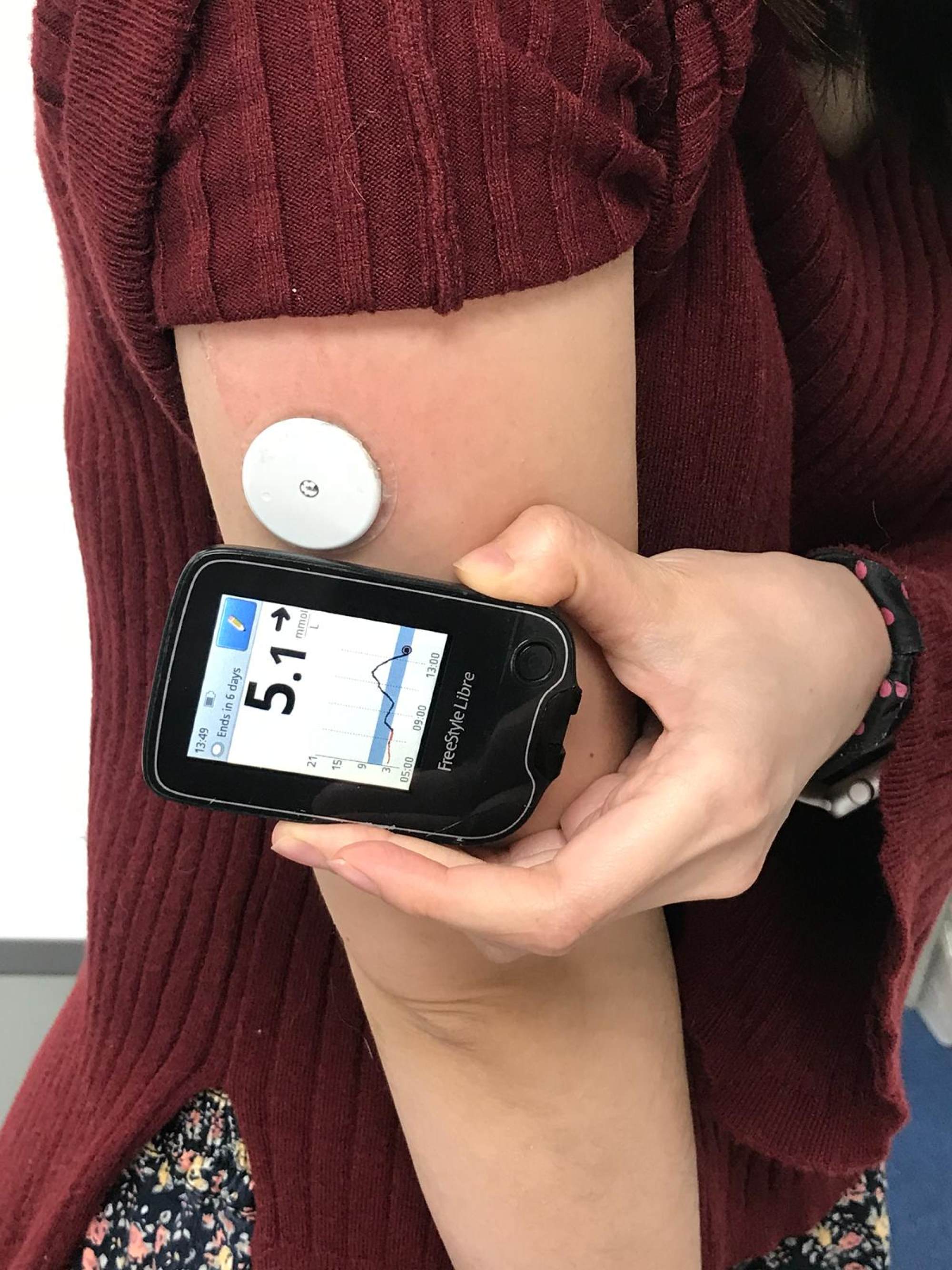 One Drop becomes first and only wireless blood glucose monitoring system to  connect directly to Apple Watch.