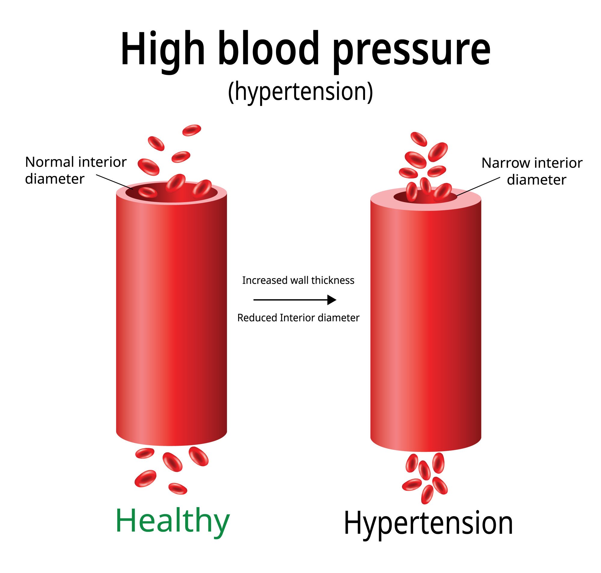 how-to-reduce-low-blood-pressure-naturally-at-home