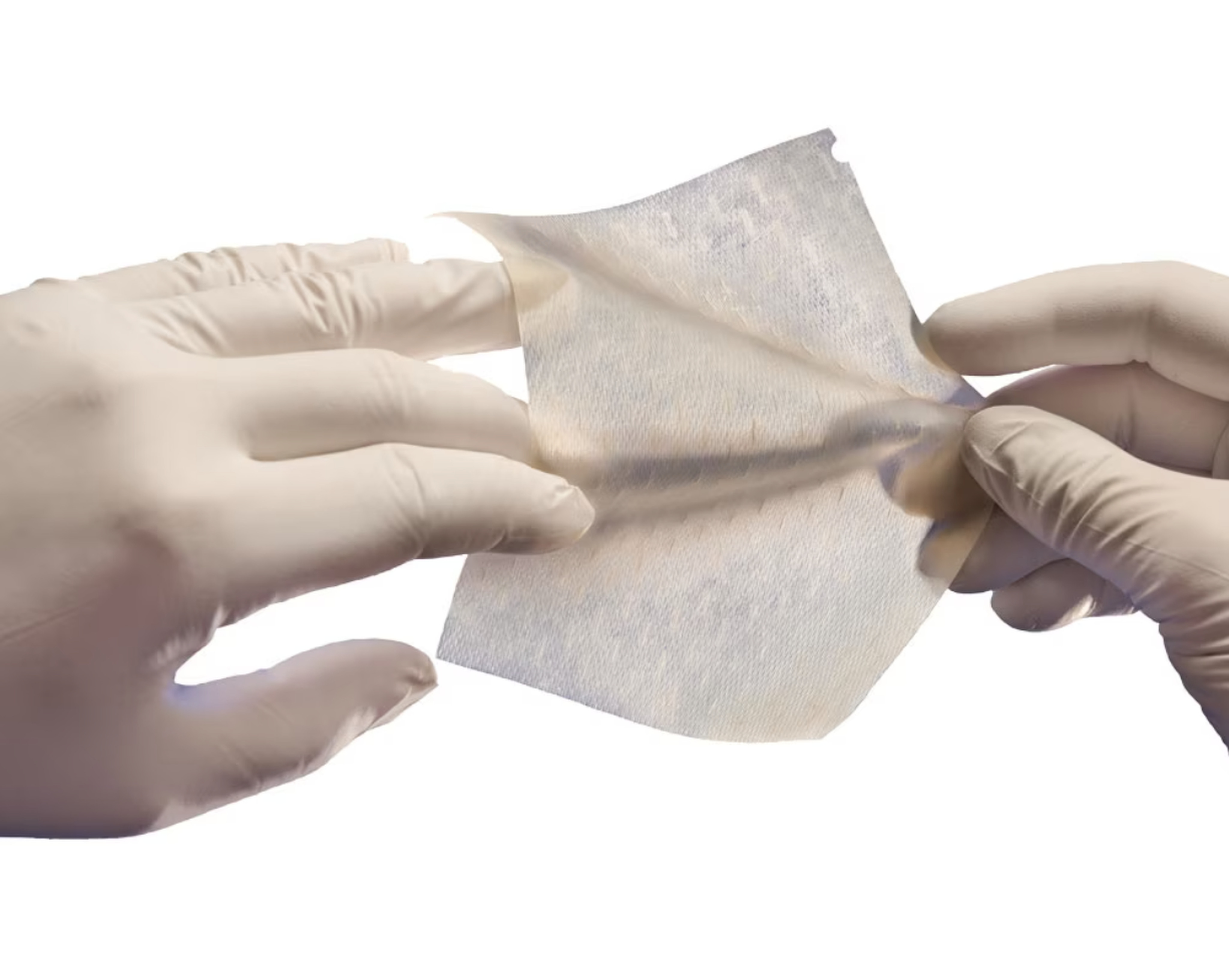 Cytal Burn Matrix is an evolution of artificial skin that is used to promote skin growth. Artificial skin’s uses have gone beyond treating burn victims to include helping fight skin cancer. Photo: Integra