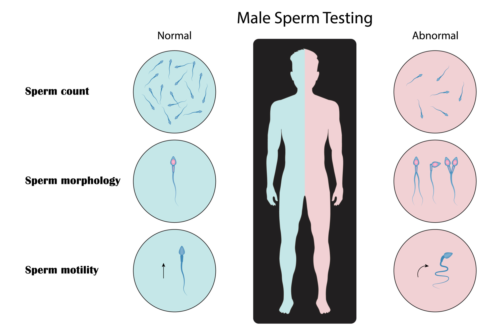 Sperm health: half of fertility problems lie with men, researcher says ...