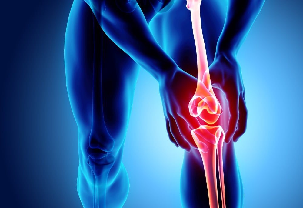 Patellar tendinopathy is a breakdown of the cells in the knee tendon. Photo: Shutterstock 