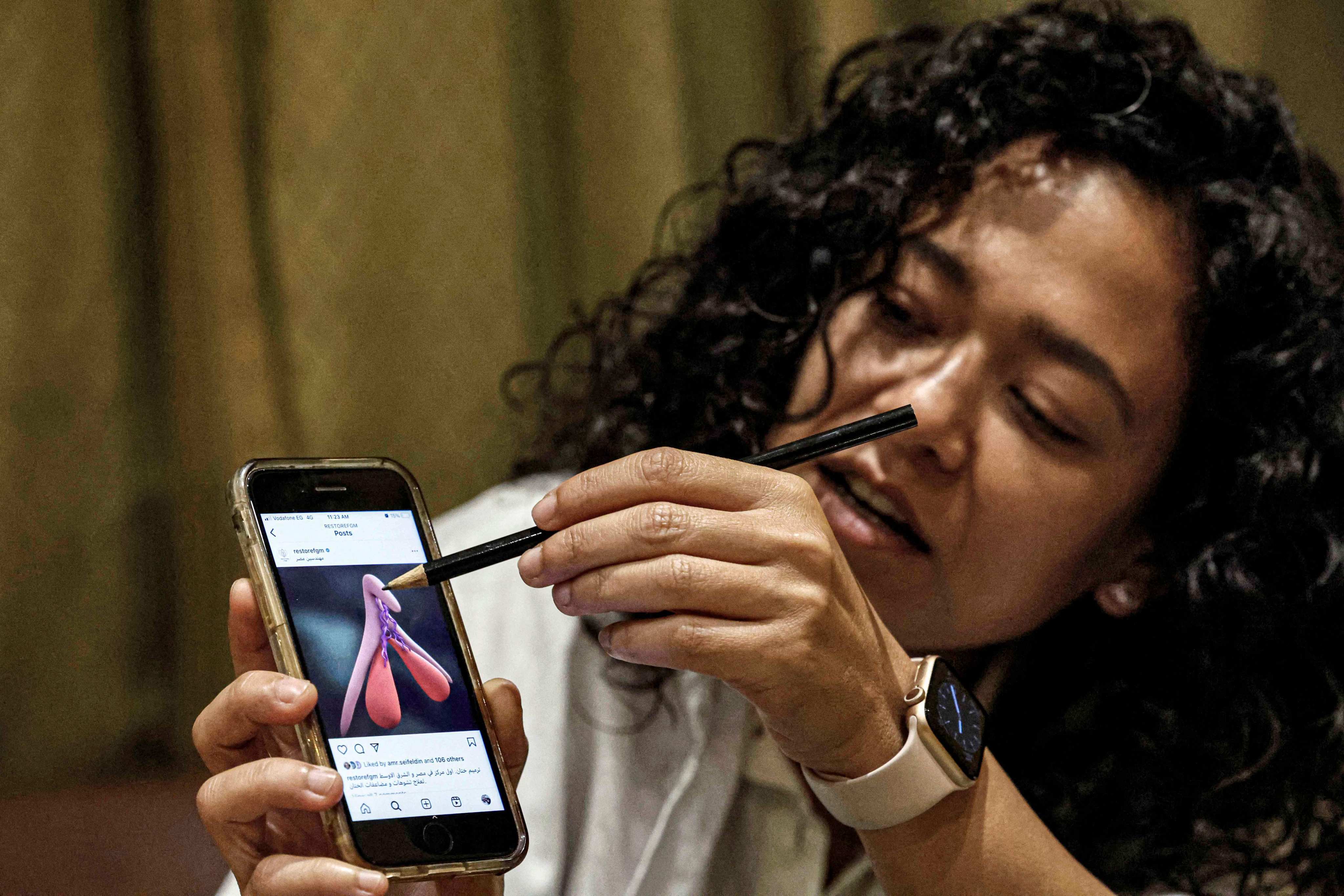 Dr Reham Awwad uses an illustration on a phone to describe clitoral reconstruction surgery at the Restore FGM clinic in Cairo. In Egypt, 86 per cent of ever-married women aged 15 to 49 have undergone female genital mutilation (FGM). Photo: AFP
