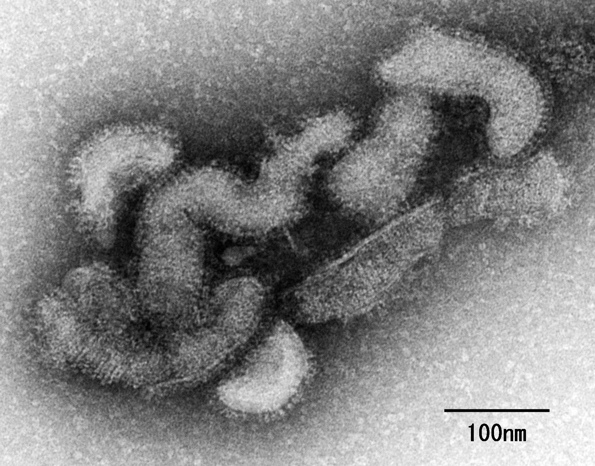 An electron micrograph of the Oz virus. Photo: EPA-EFE/National Institute of Infectious Diseases