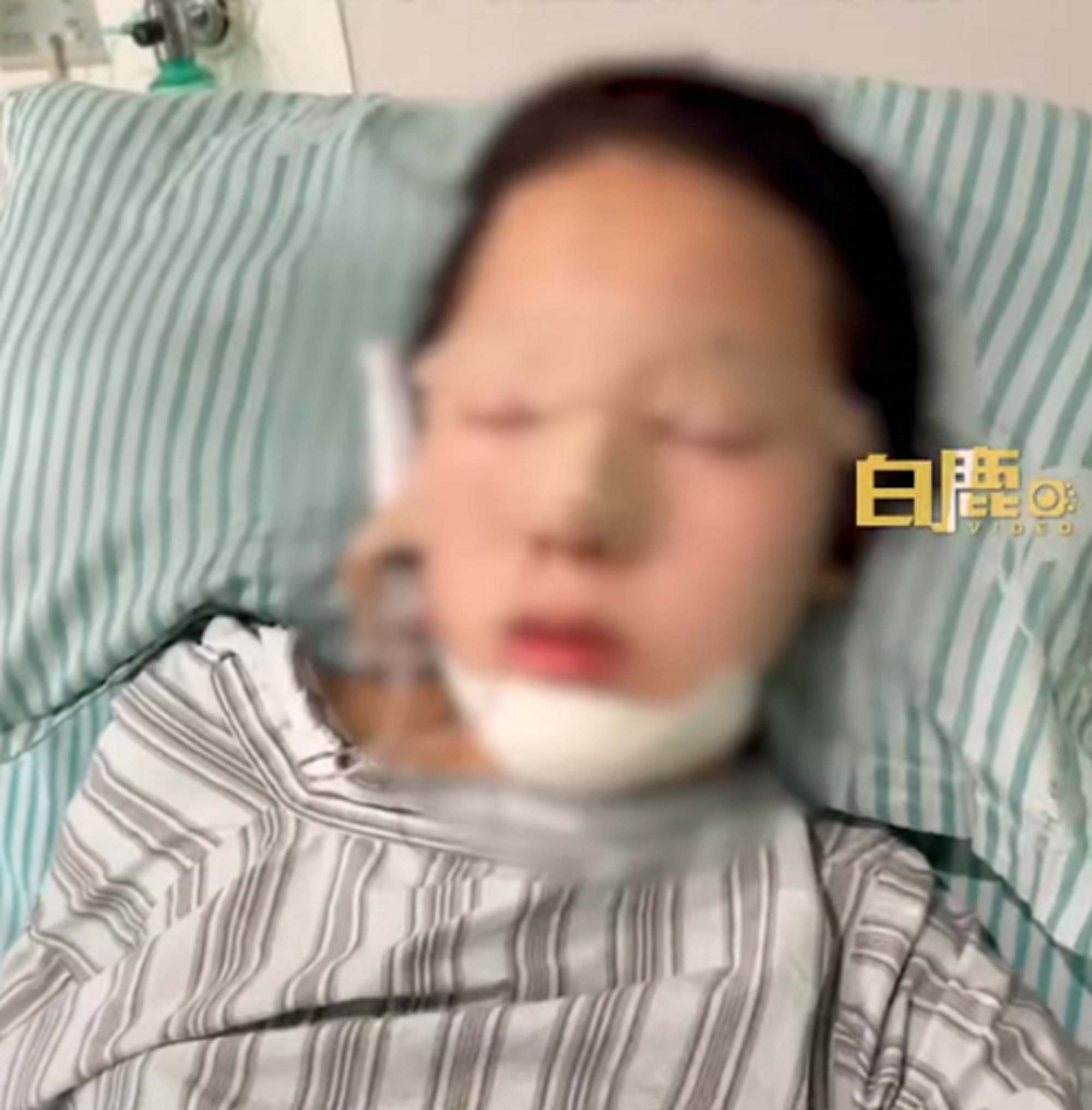 Family and friends were delighted with the results of the surgery, describing the girl’s new look as “beautiful”. Photo: Weibo