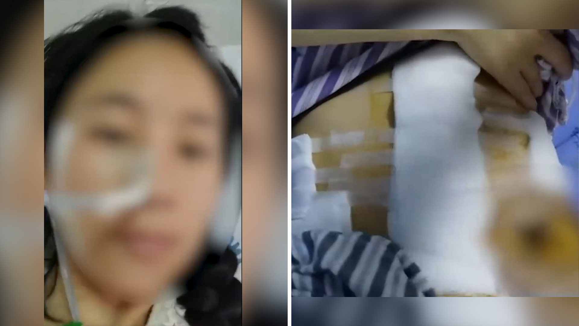 A woman in China has been left needing to wear a colostomy bag for the rest of her life after a string of violent attacks by her husband over a two-year period. Photo: SCMP composite/Weibo